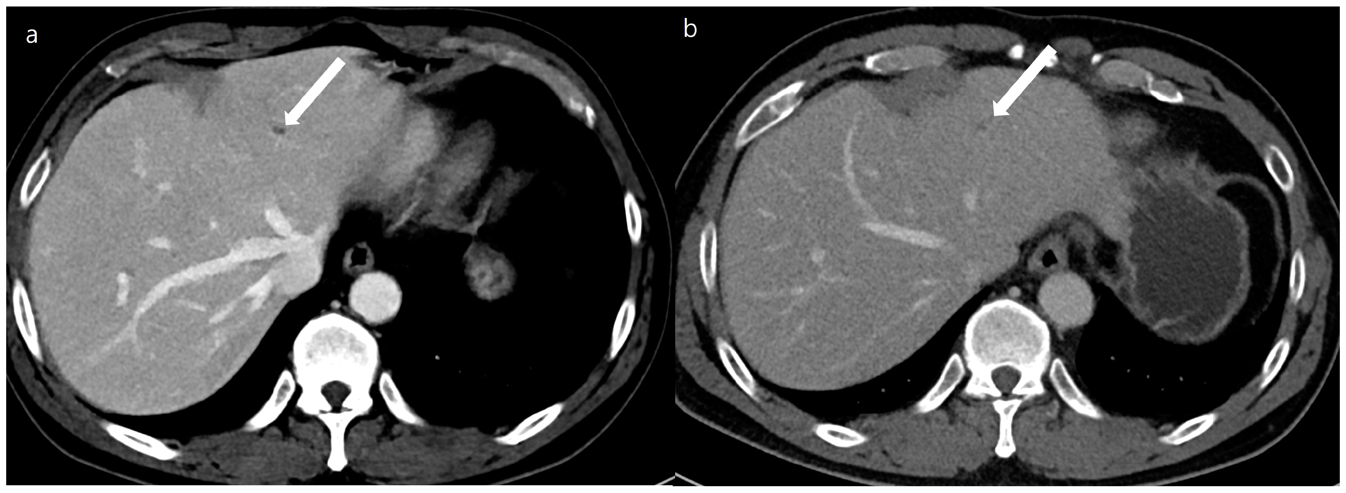 Diagnostics 14 02308 g004