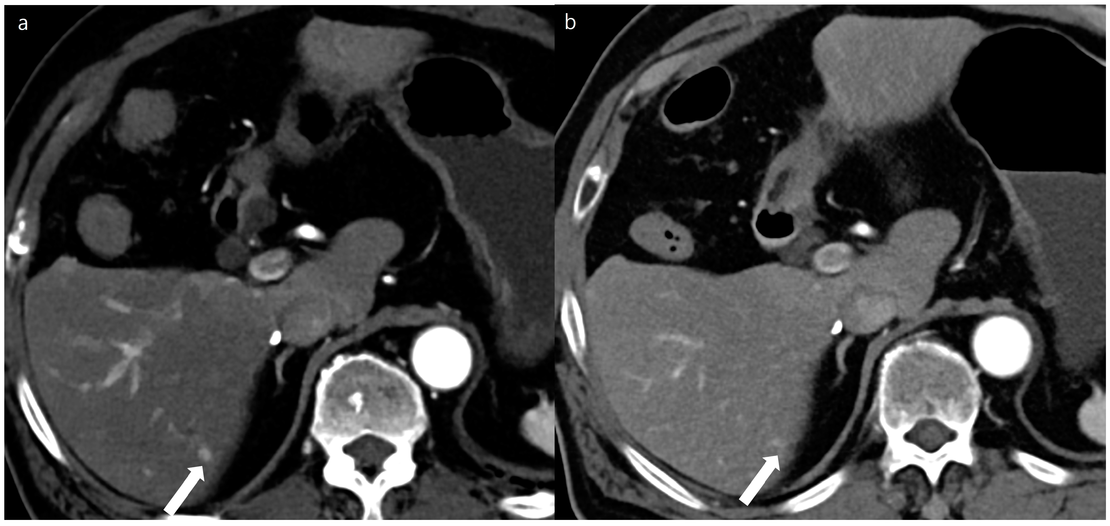 Diagnostics 14 02308 g005
