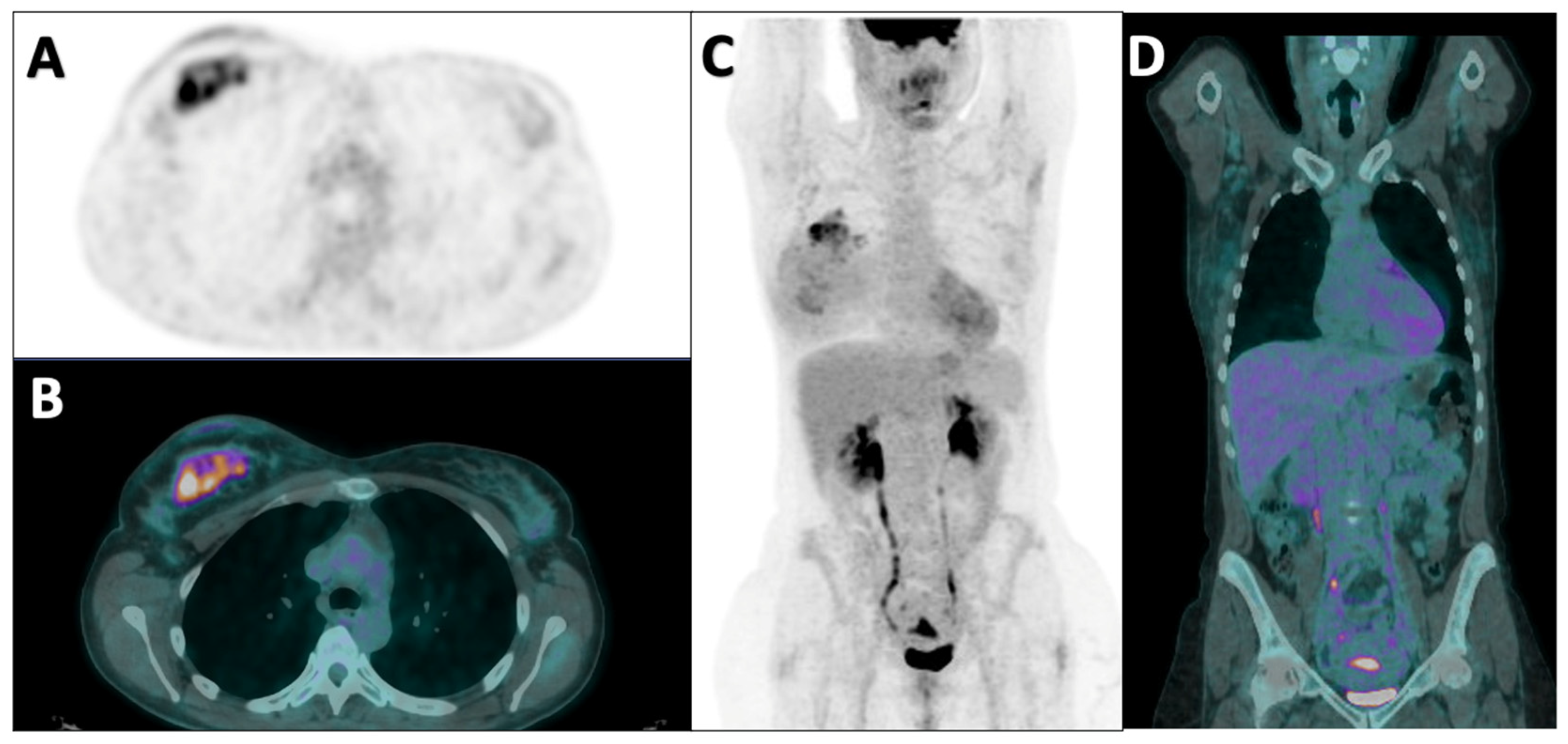 Diagnostics 14 02312 g001