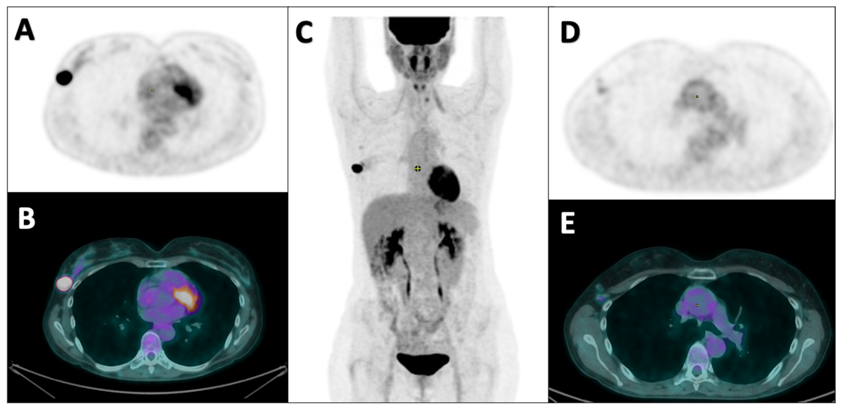 Diagnostics 14 02312 g002