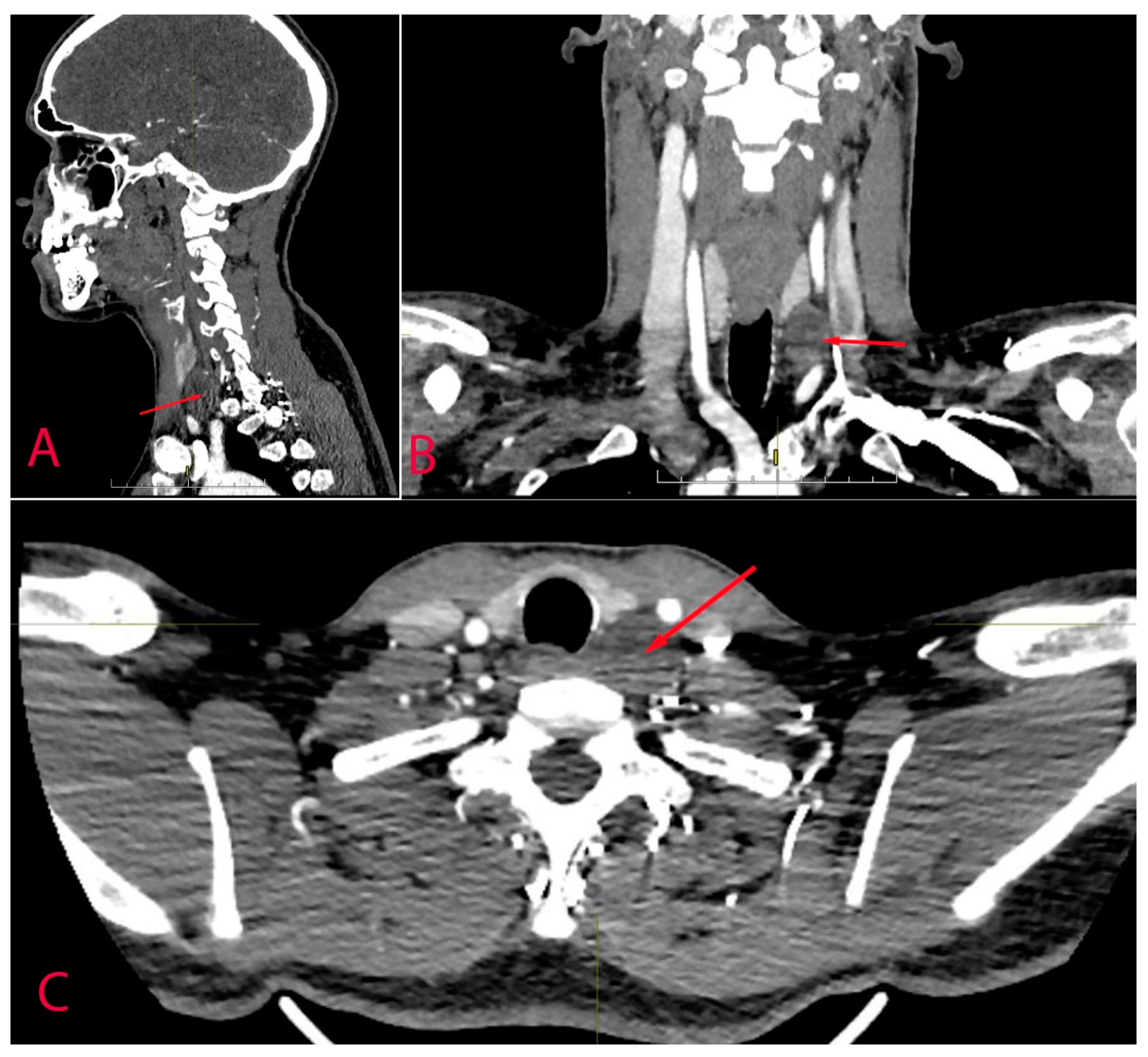 Diagnostics 14 02332 g003 Diagnostics 14 02332 g003