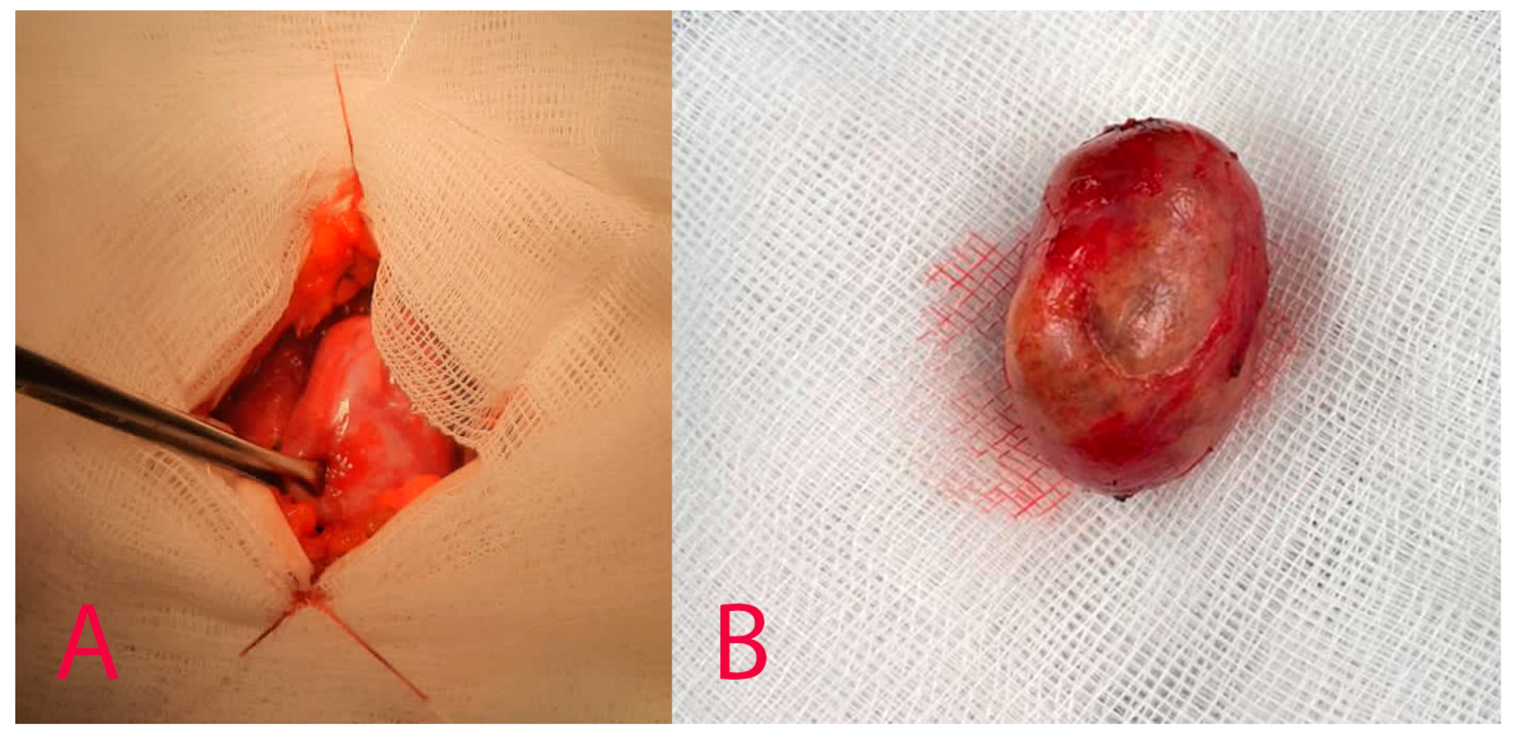 Diagnostics 14 02332 g005 Diagnostics 14 02332 g005