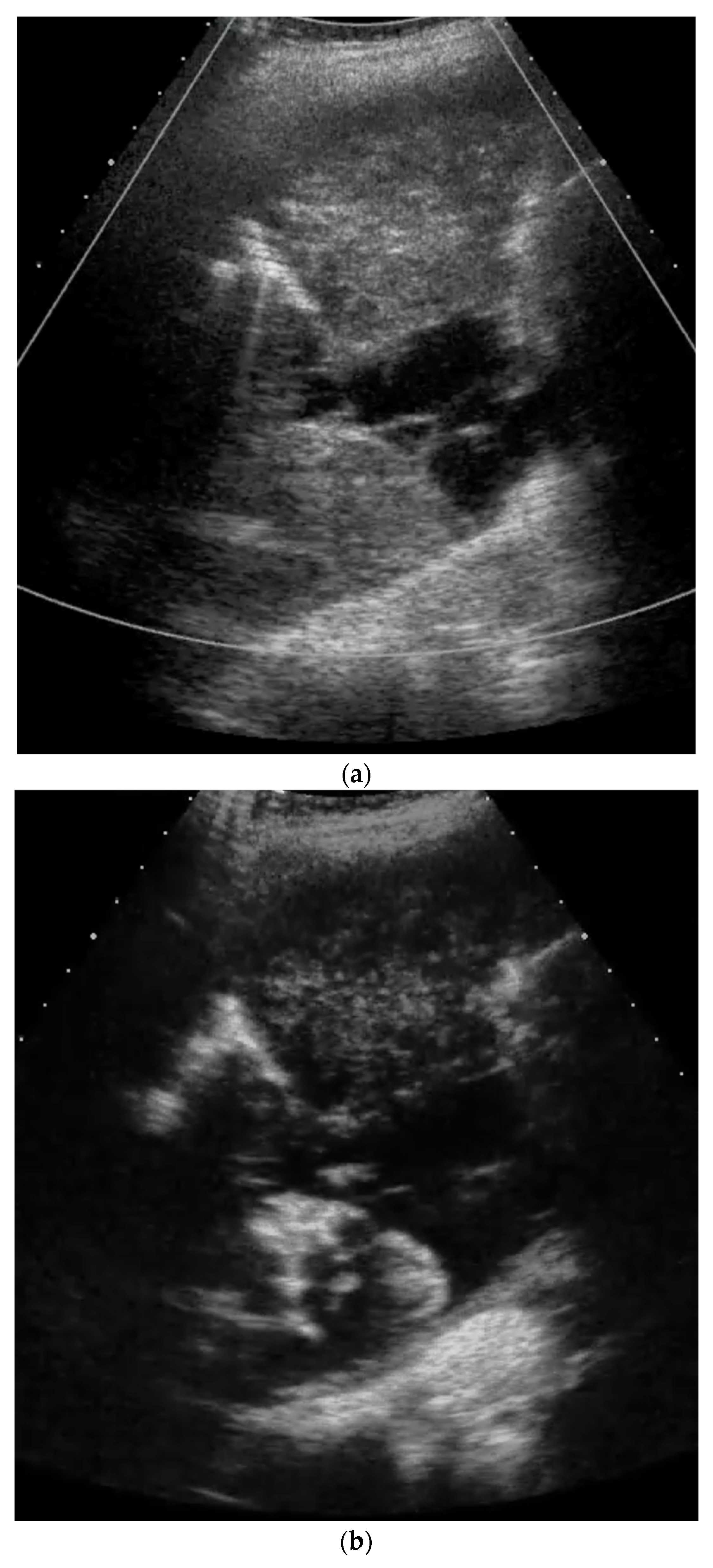 Diagnostics 14 02339 g001a