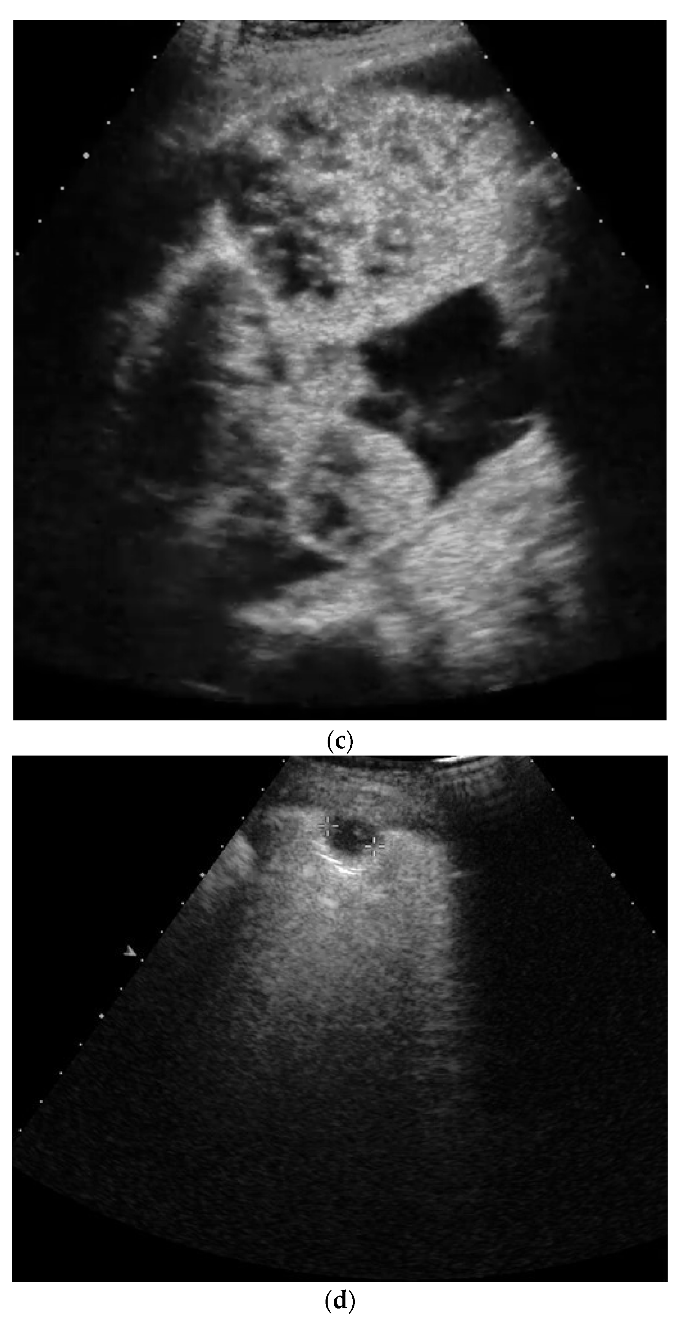 Diagnostics 14 02339 g001b
