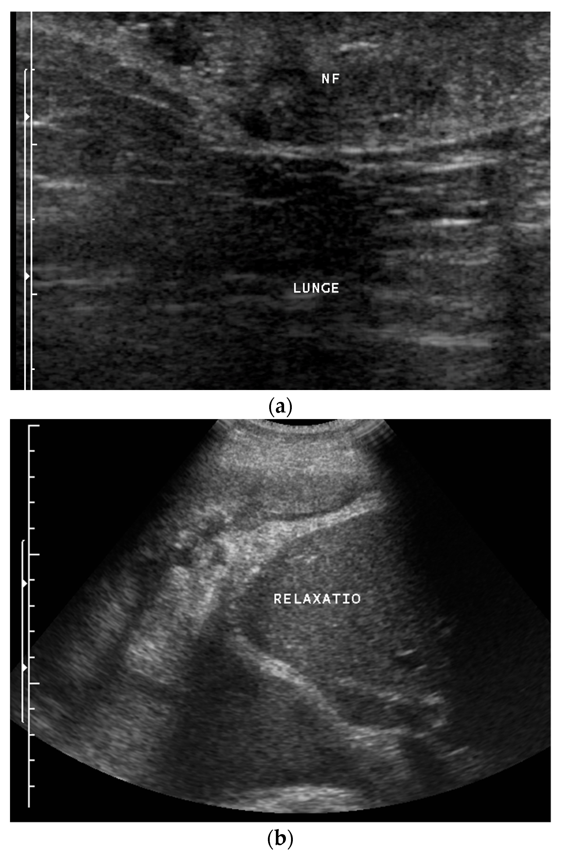 Diagnostics 14 02339 g002