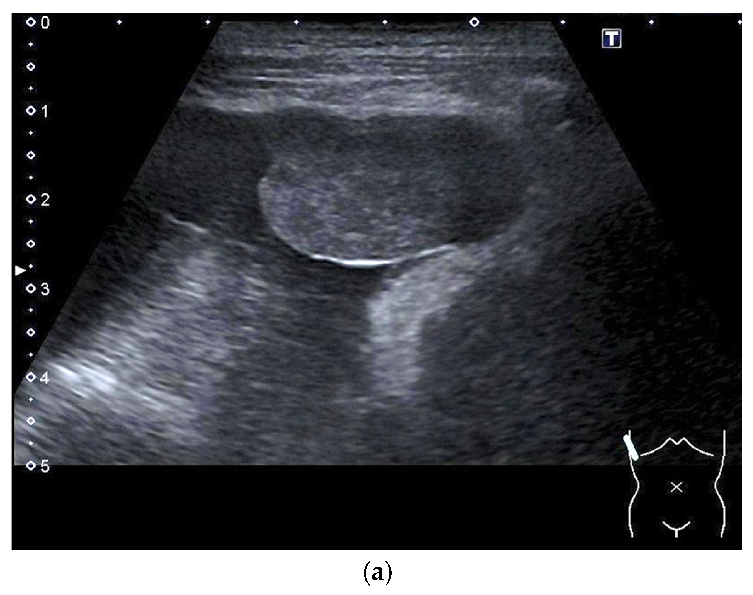 Diagnostics 14 02339 g003a