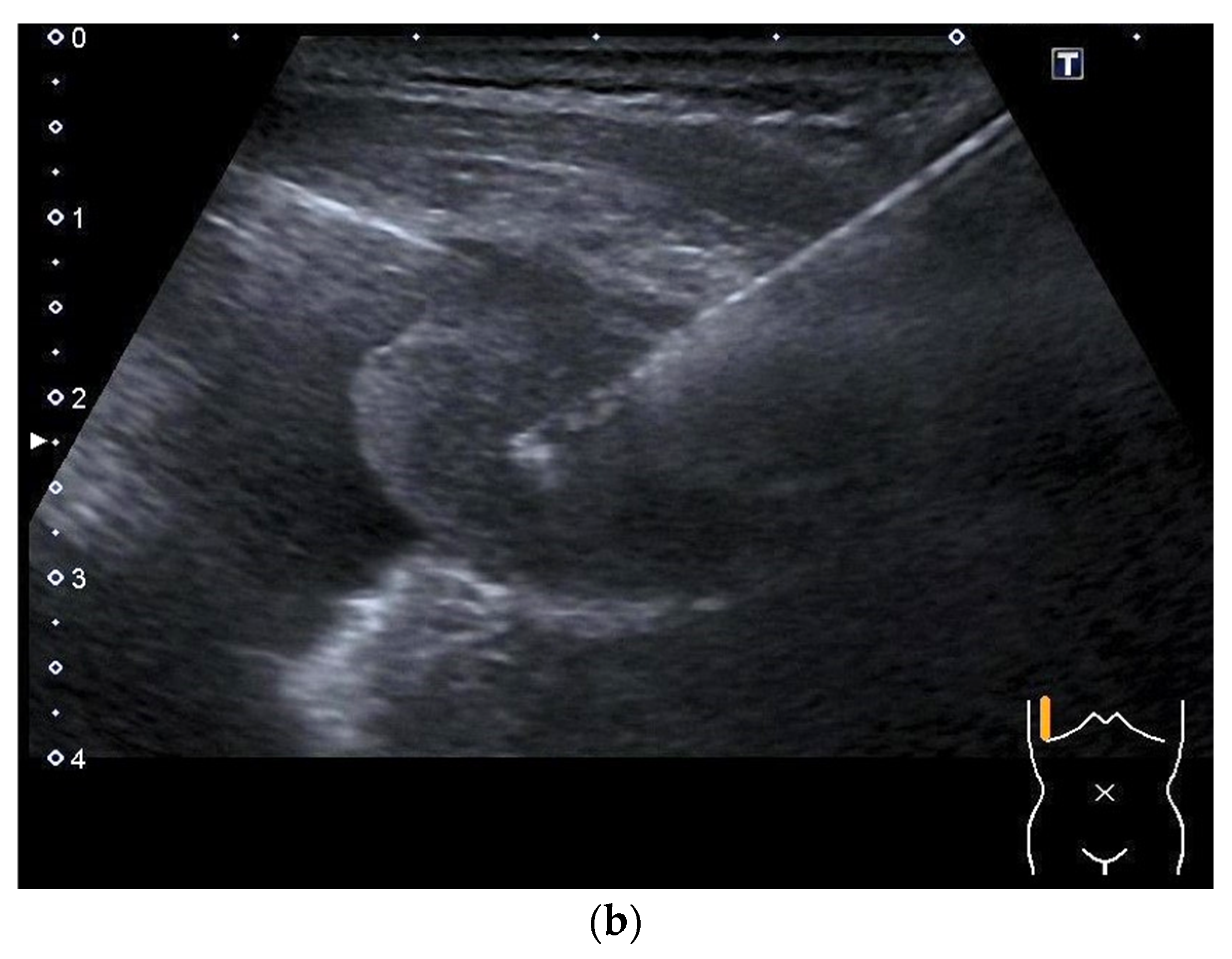 Diagnostics 14 02339 g003b