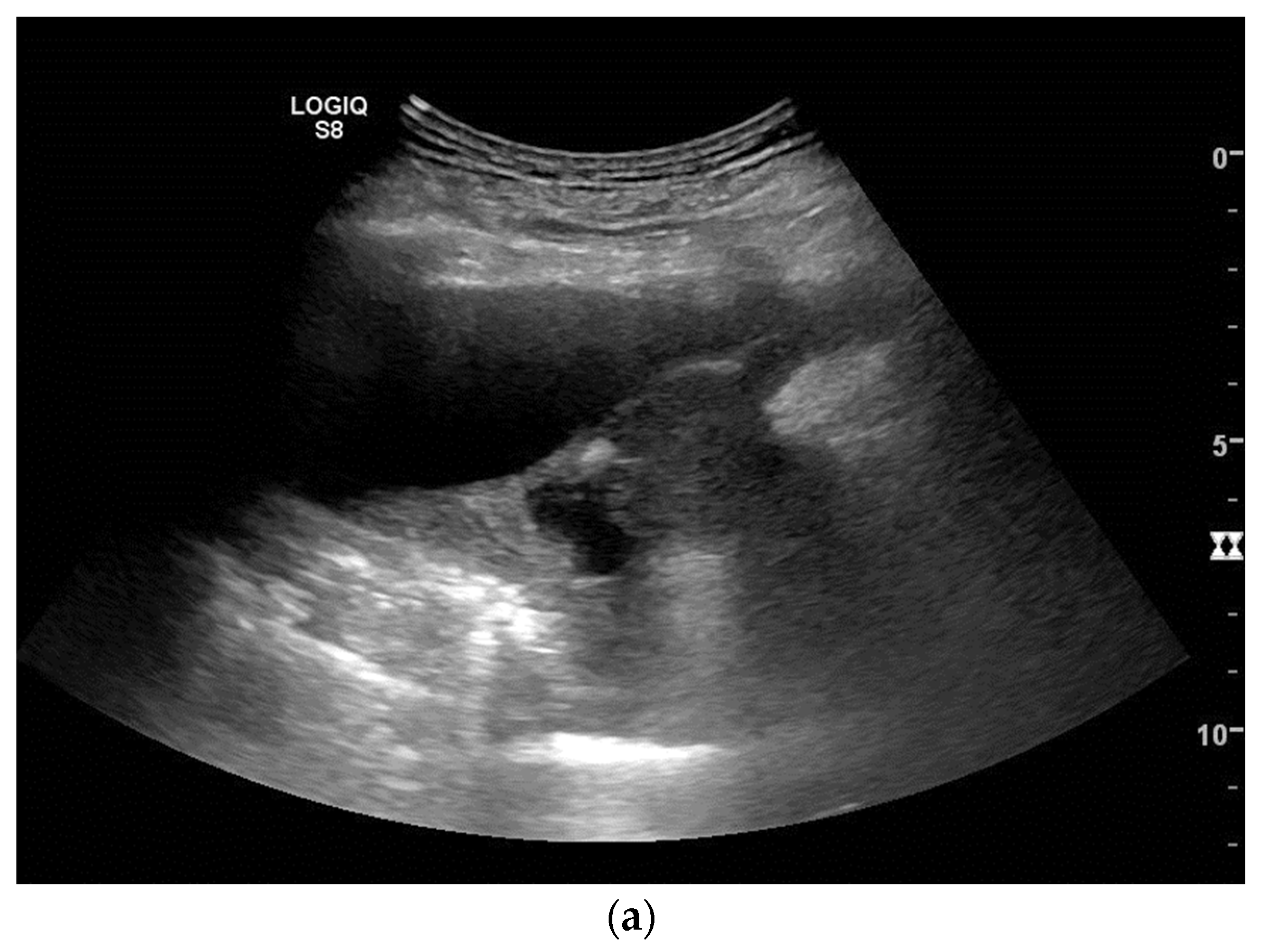 Diagnostics 14 02339 g004a