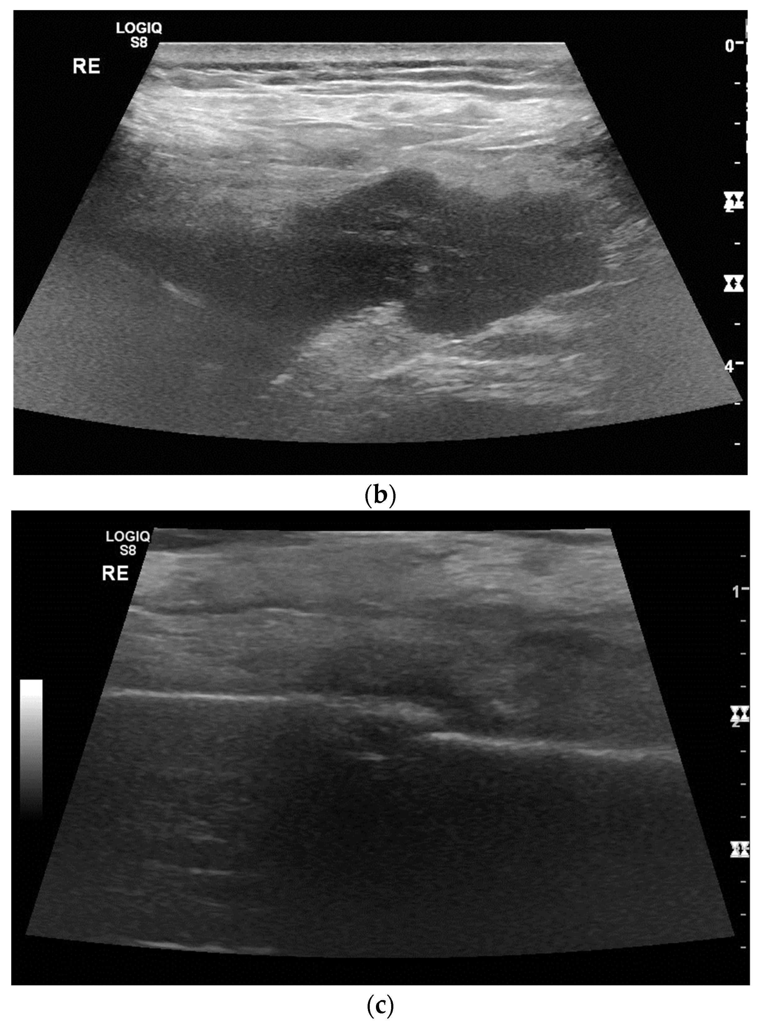 Diagnostics 14 02339 g004b