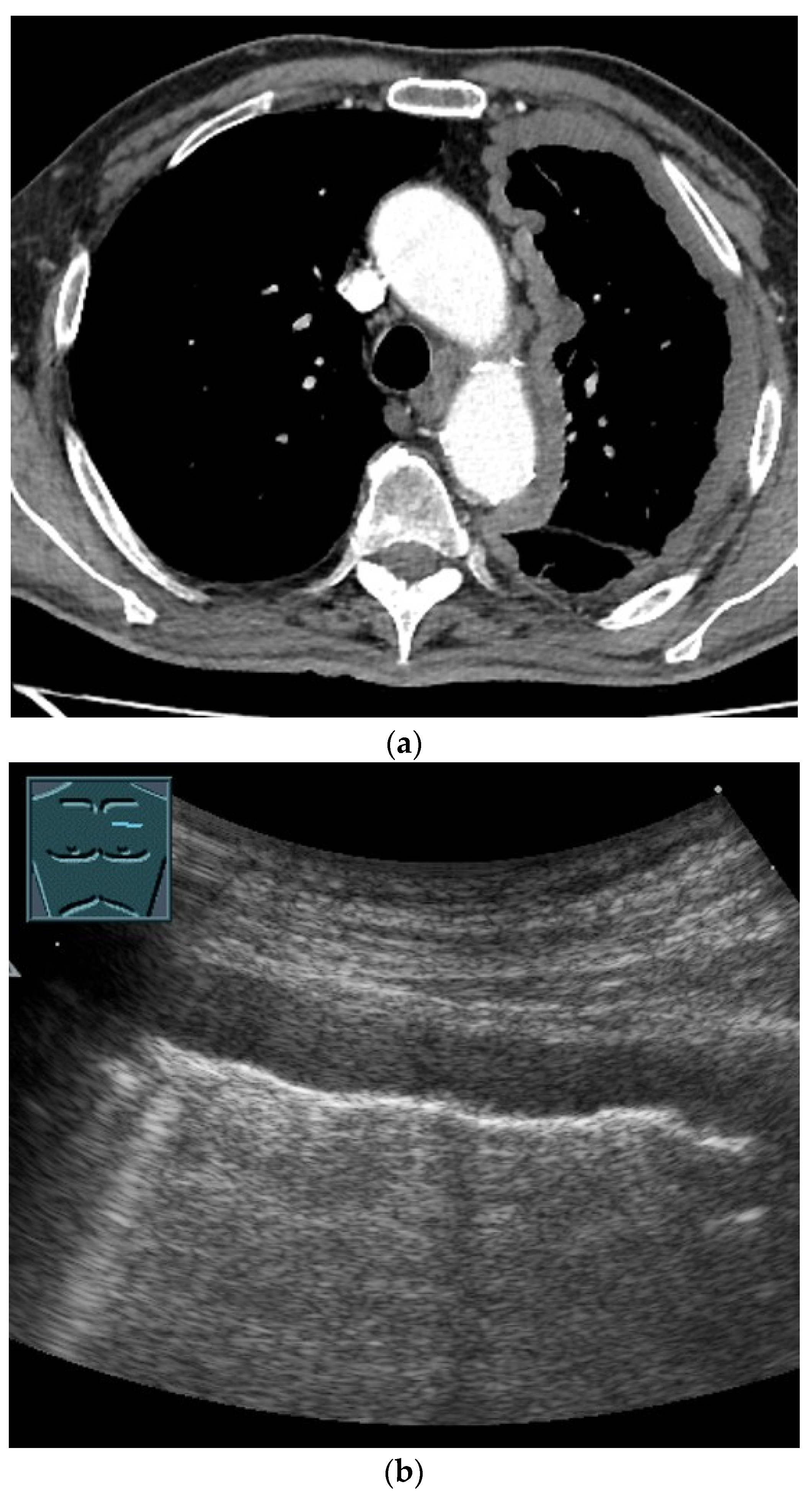 Diagnostics 14 02339 g005a