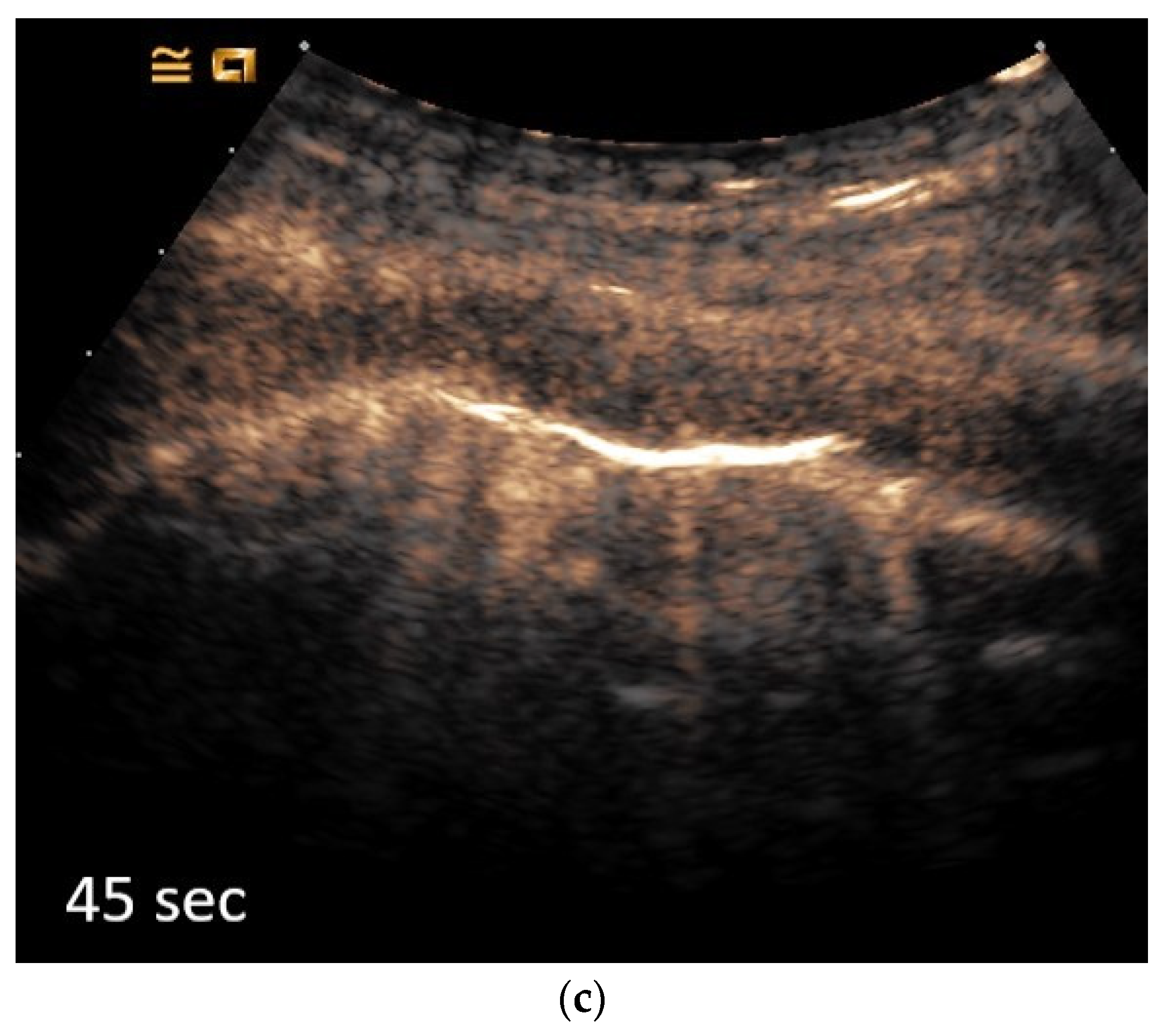 Diagnostics 14 02339 g005b