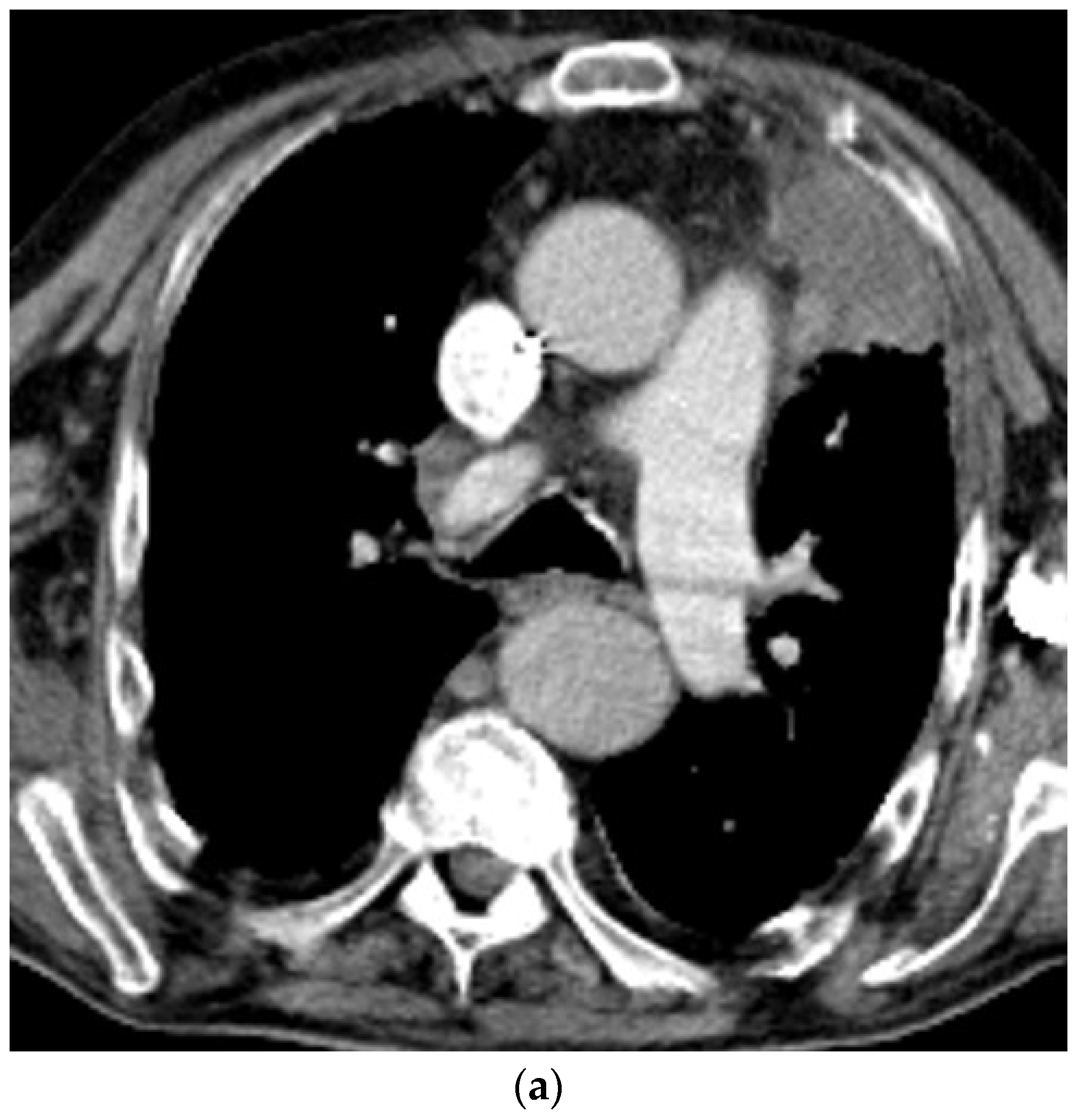Diagnostics 14 02339 g006a