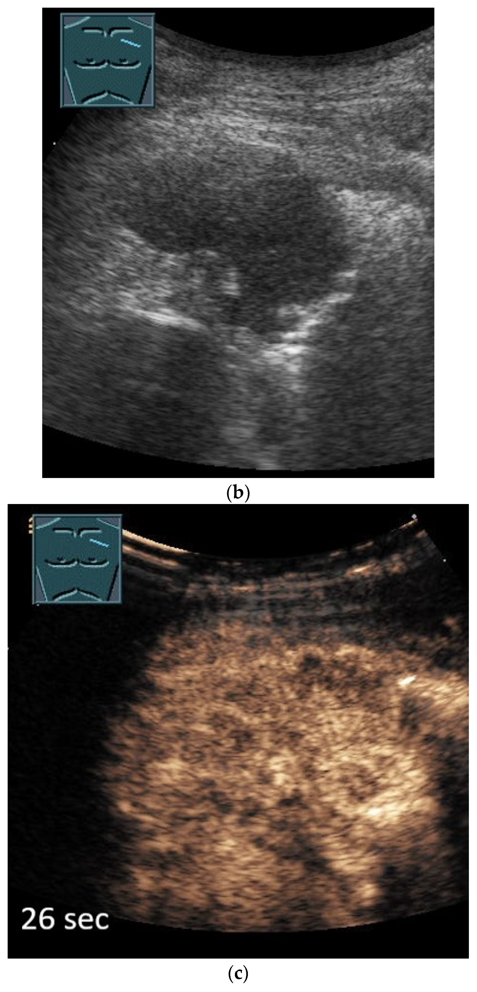 Diagnostics 14 02339 g006b