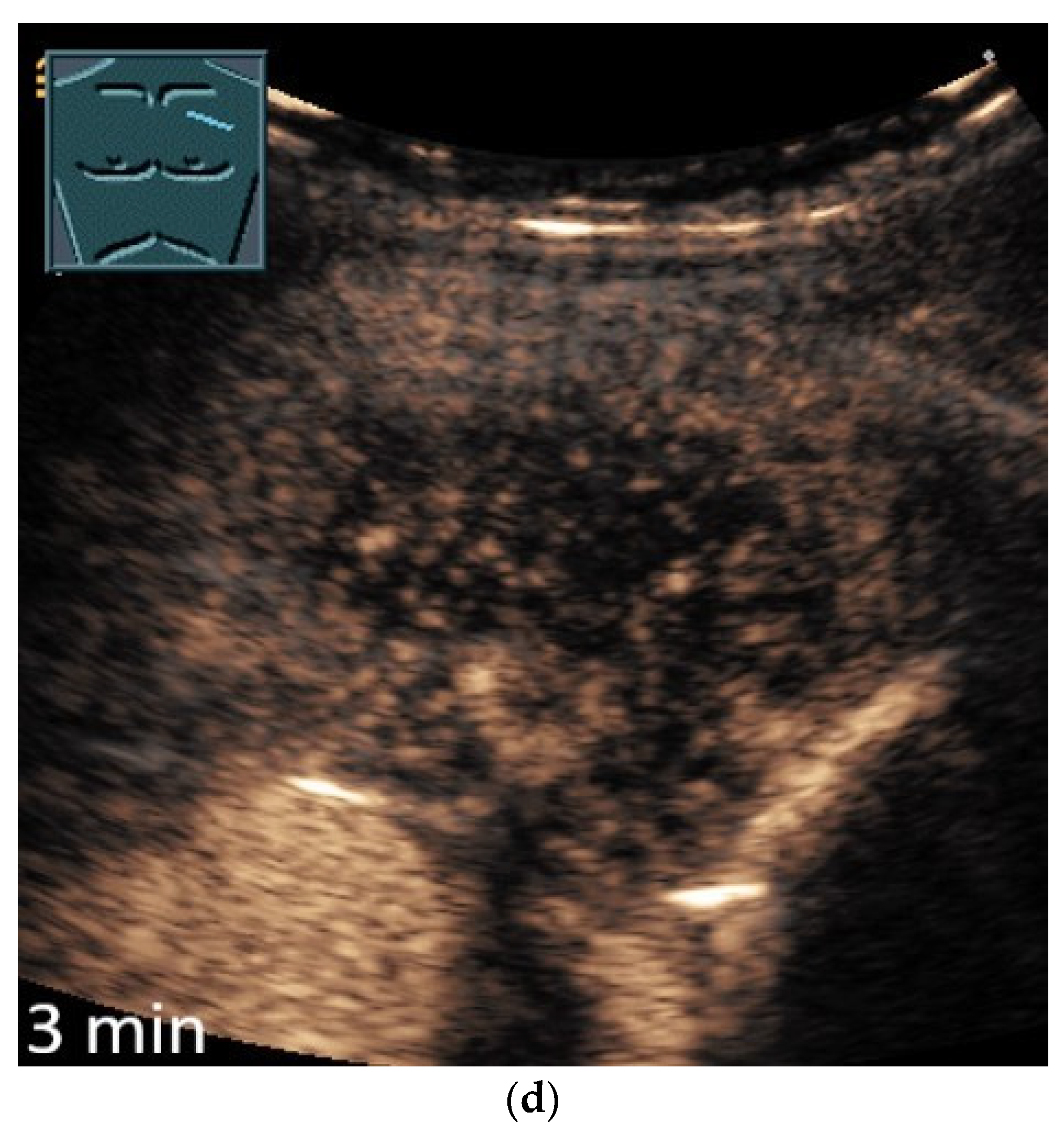 Diagnostics 14 02339 g006c