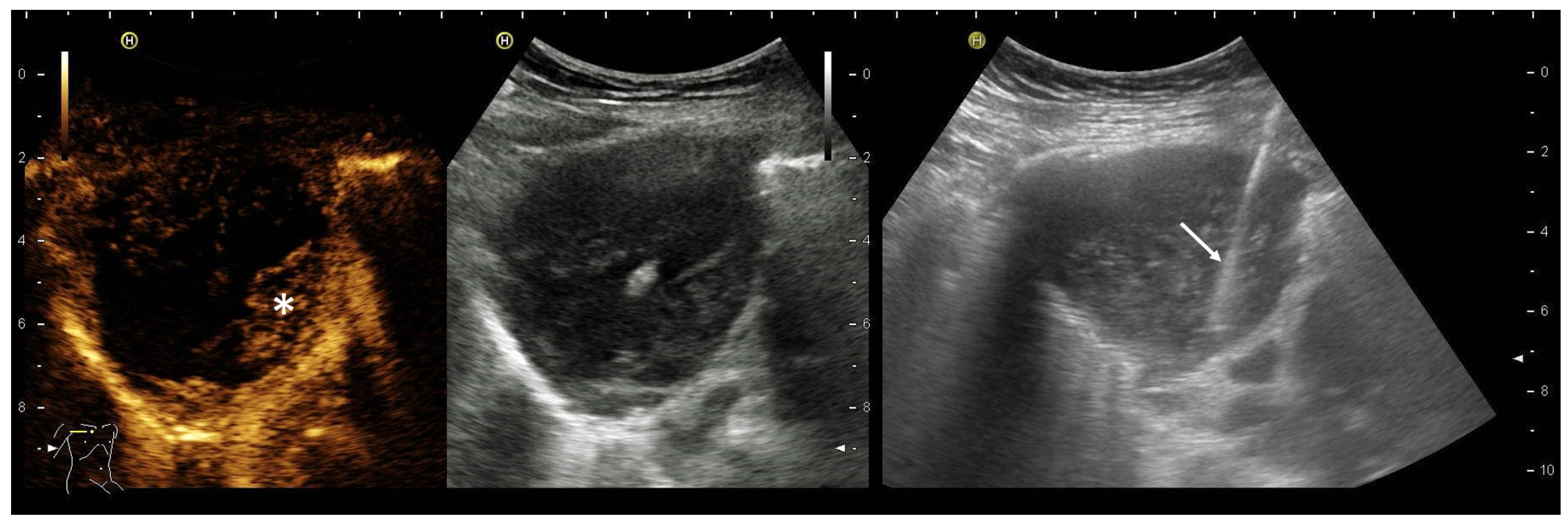 Diagnostics 14 02339 g007