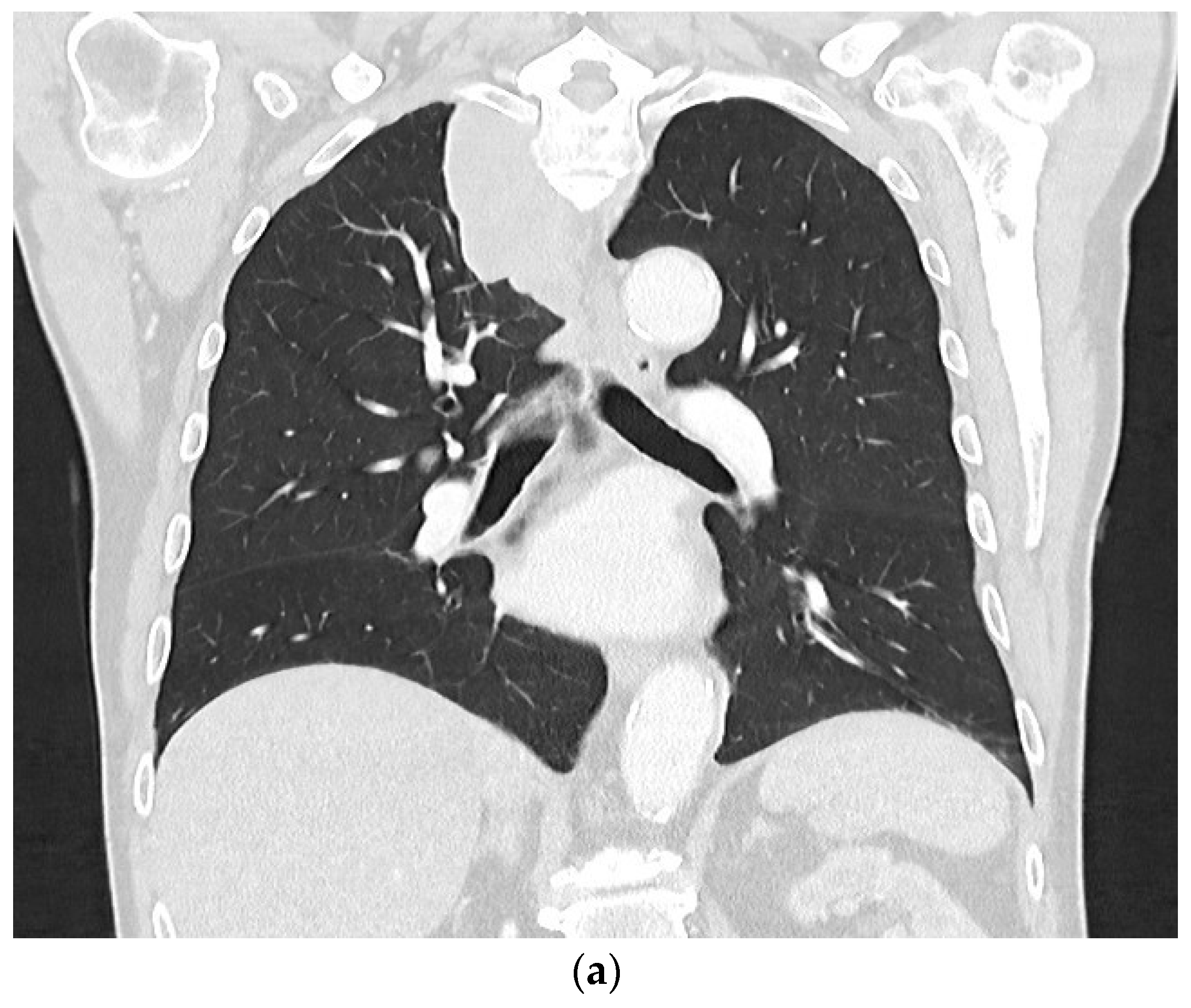 Diagnostics 14 02339 g008a