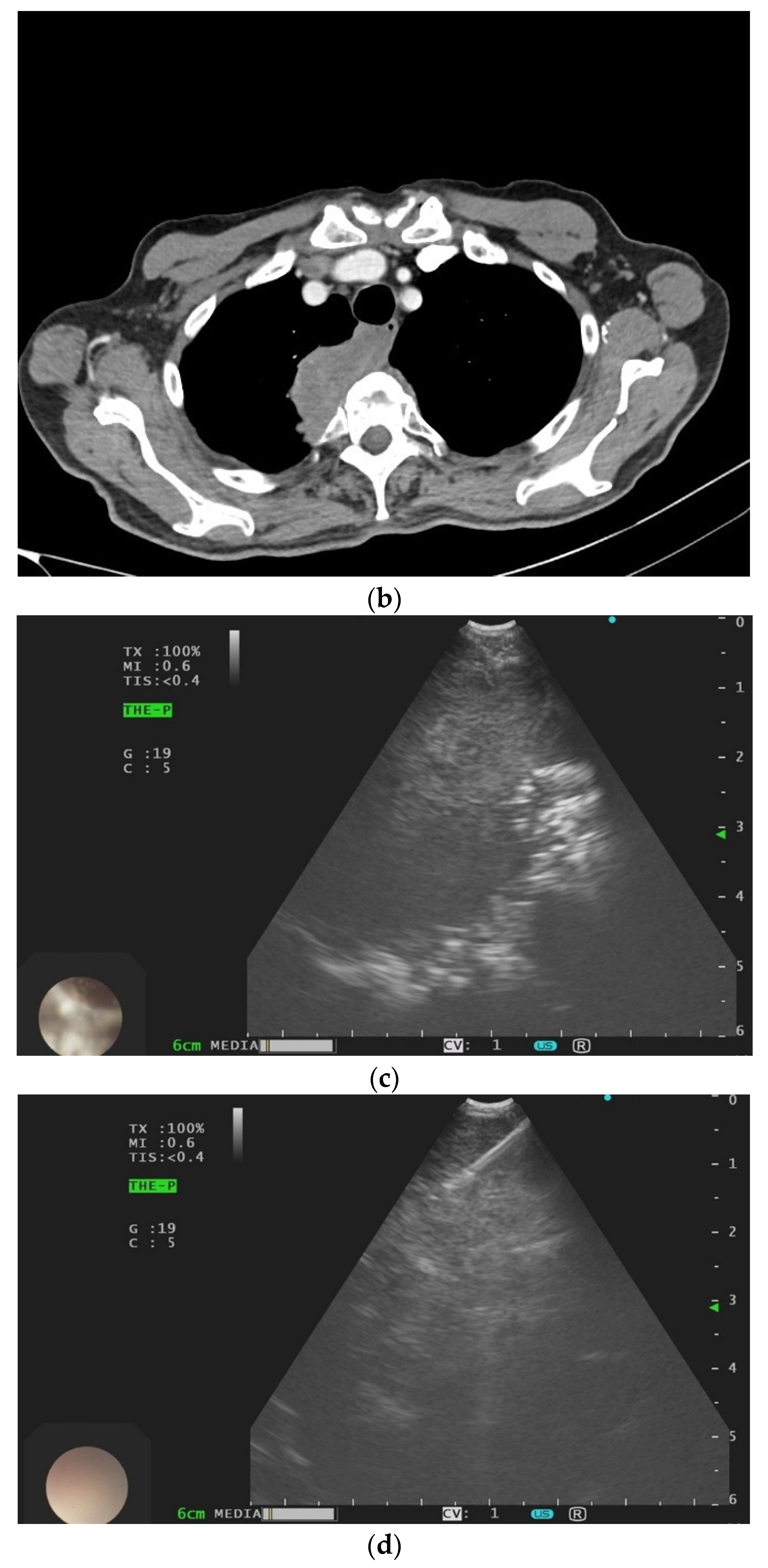 Diagnostics 14 02339 g008b