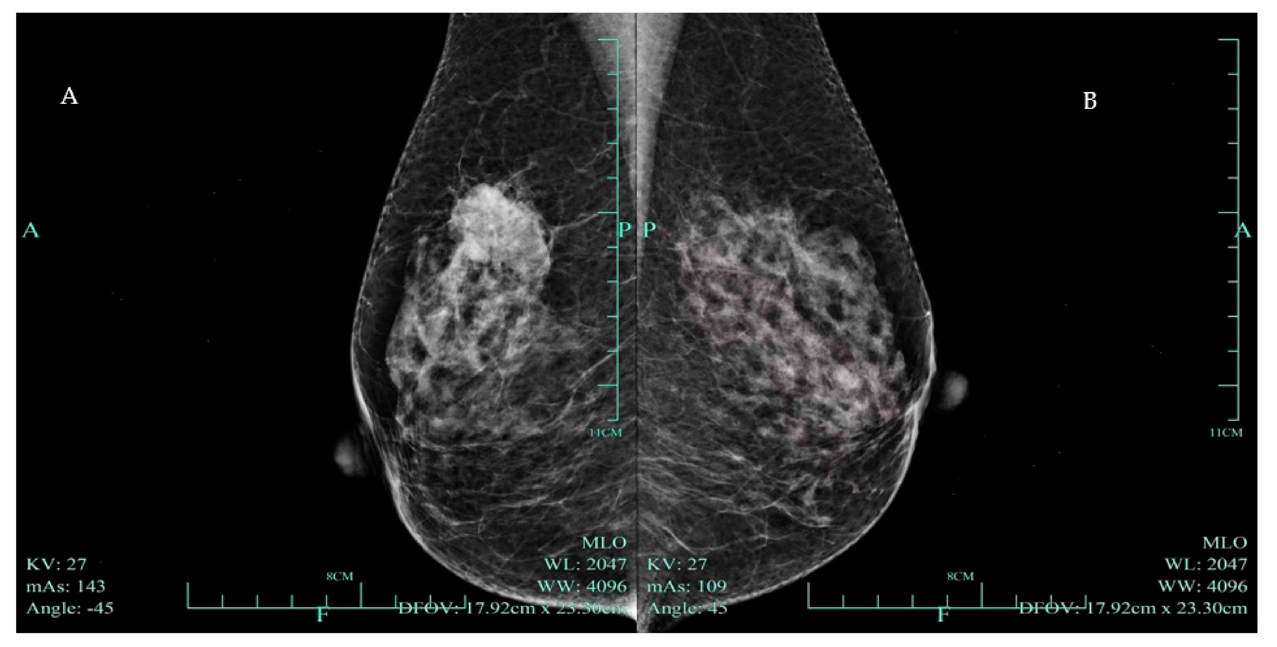 Diagnostics 14 02347 g001