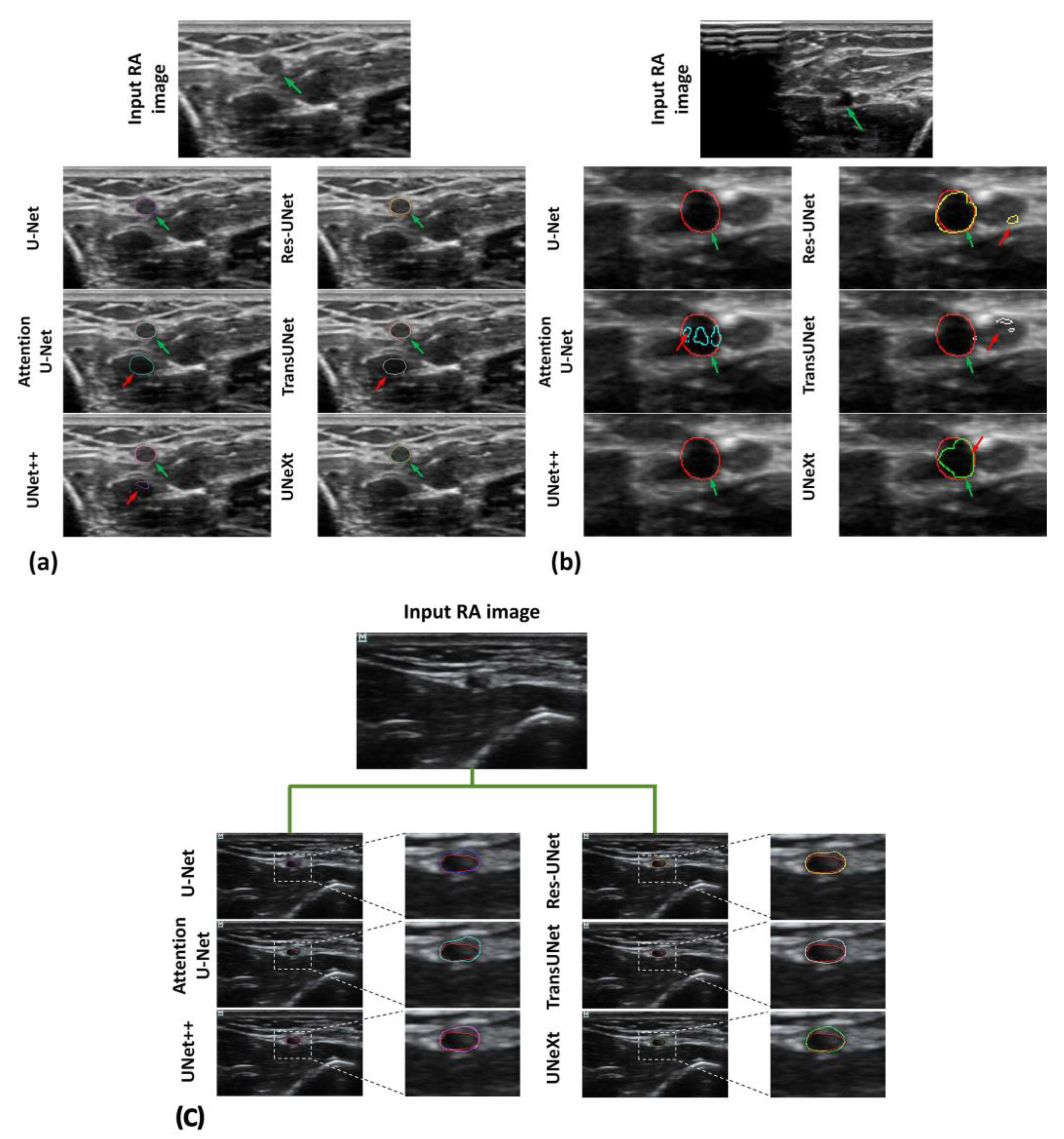 Diagnostics 14 02358 g007