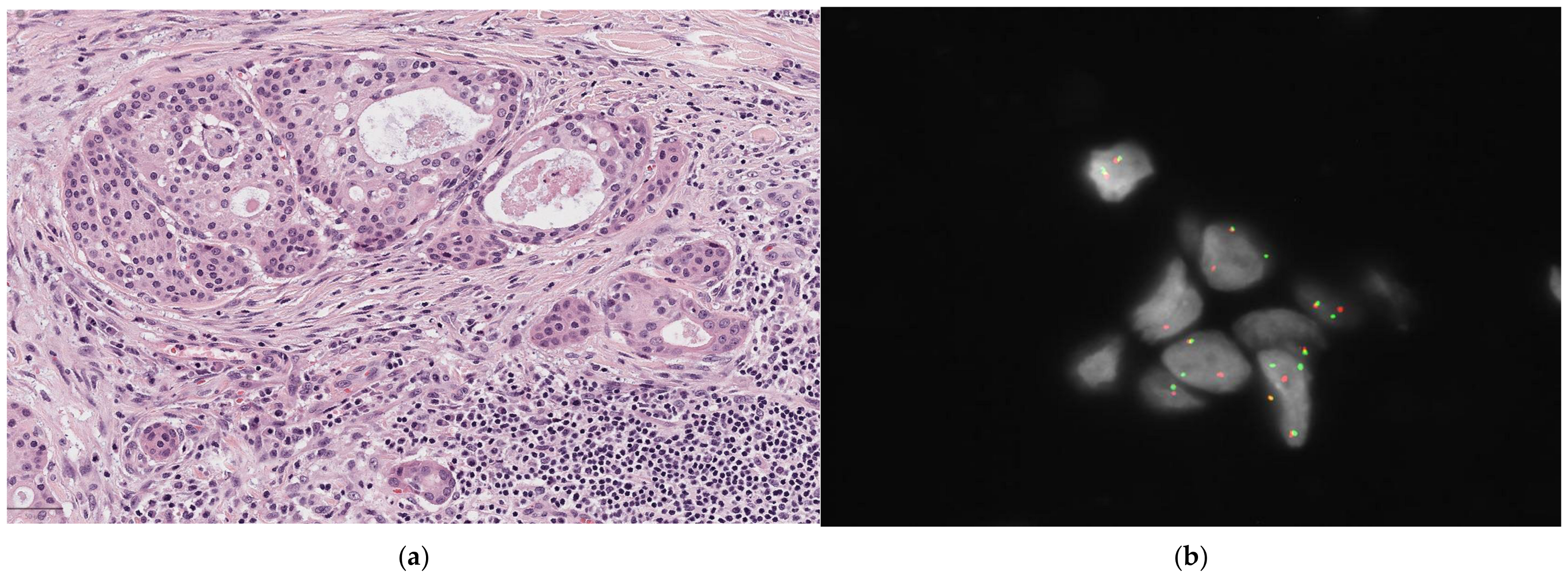 Diagnostics 14 02365 g003 Diagnostics 14 02365 g003