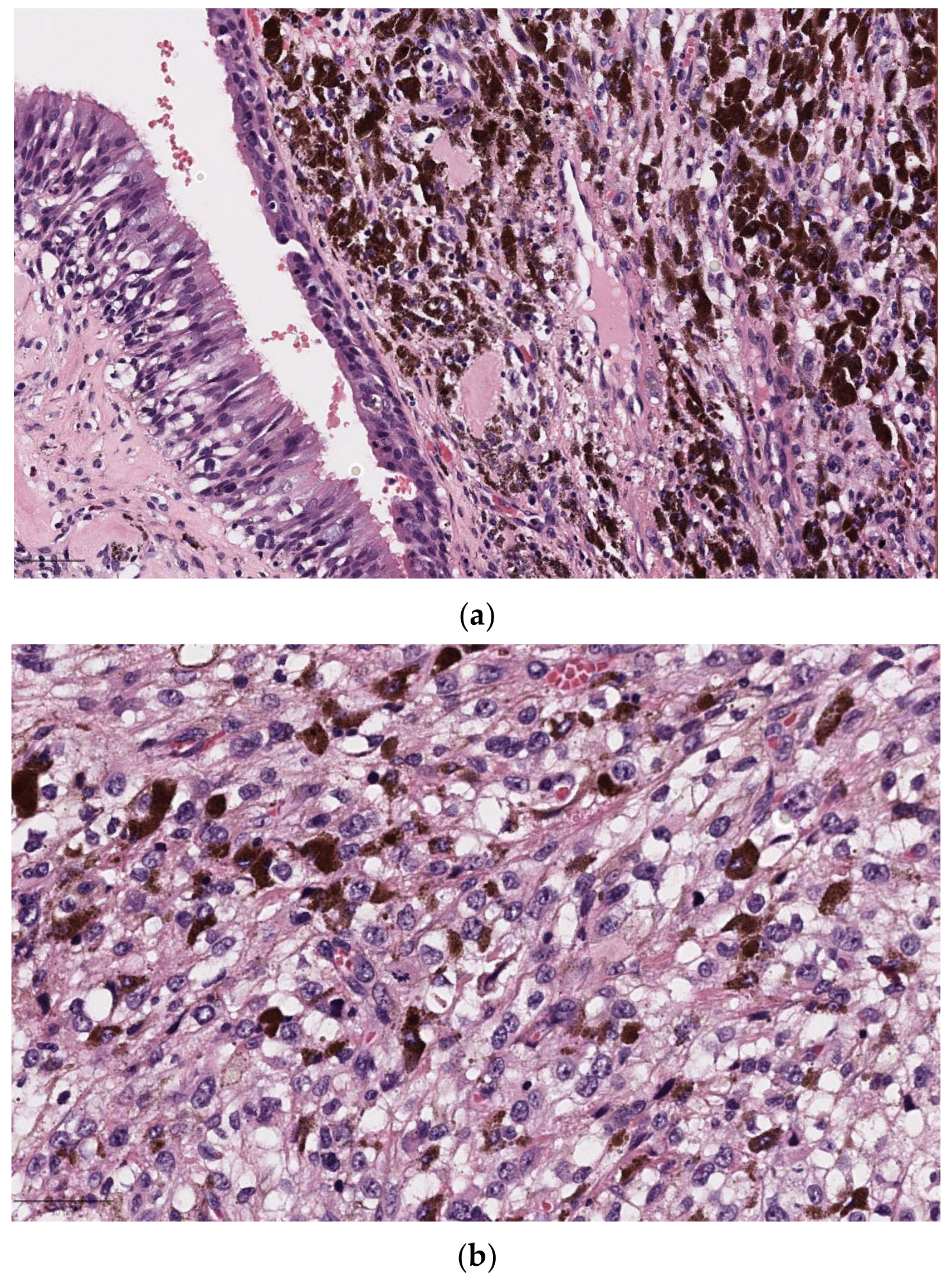 Diagnostics 14 02365 g005 Diagnostics 14 02365 g005