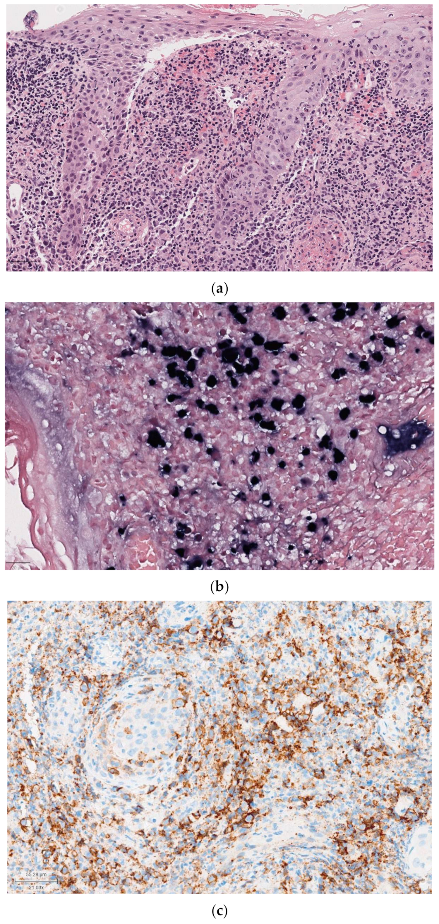 Diagnostics 14 02365 g006 Diagnostics 14 02365 g006