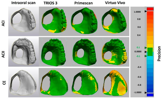 The Accuracy of Intraoral Scanners in Maxillary Defects with Different ...