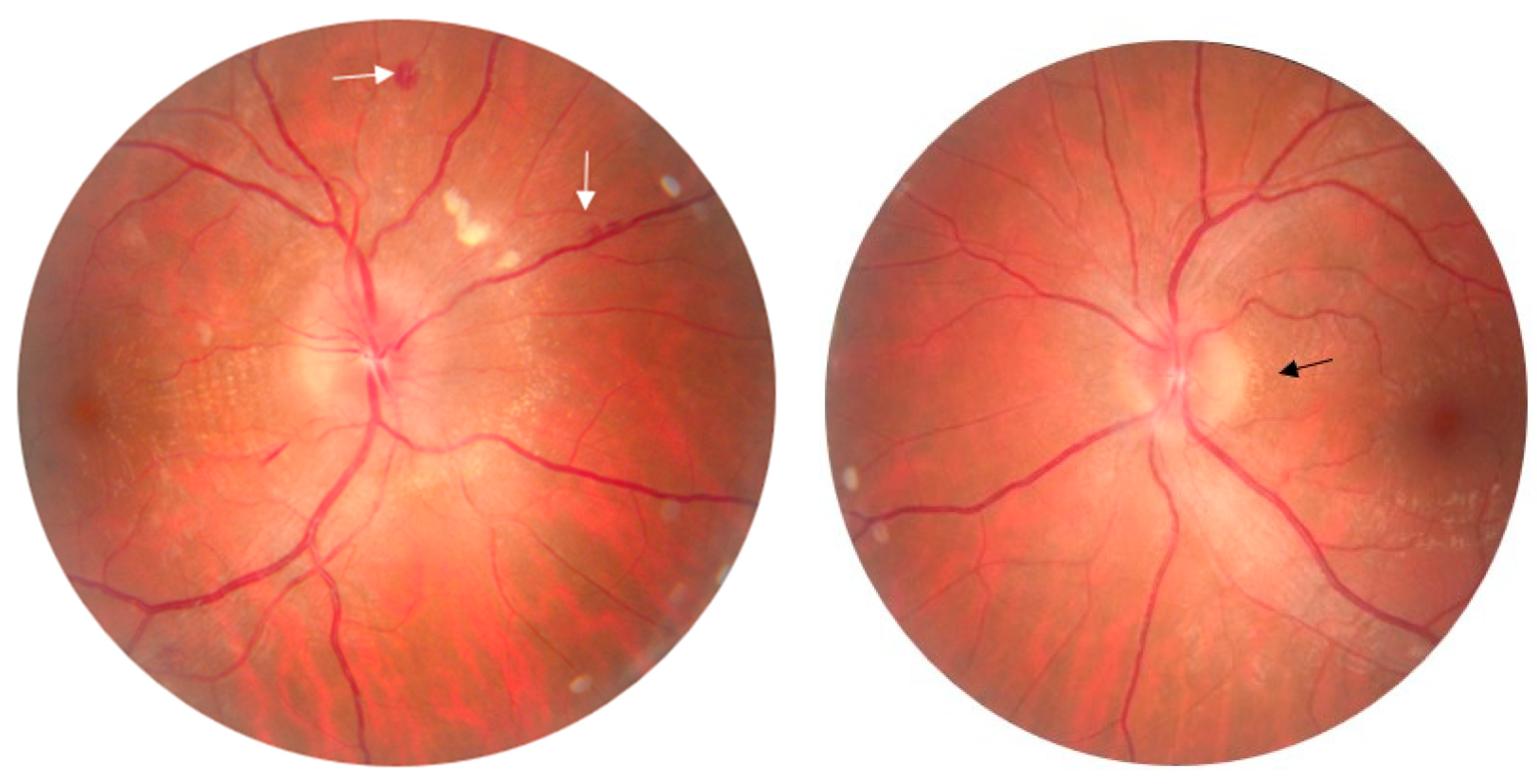 Diagnostics 14 02386 g001 Diagnostics 14 02386 g001