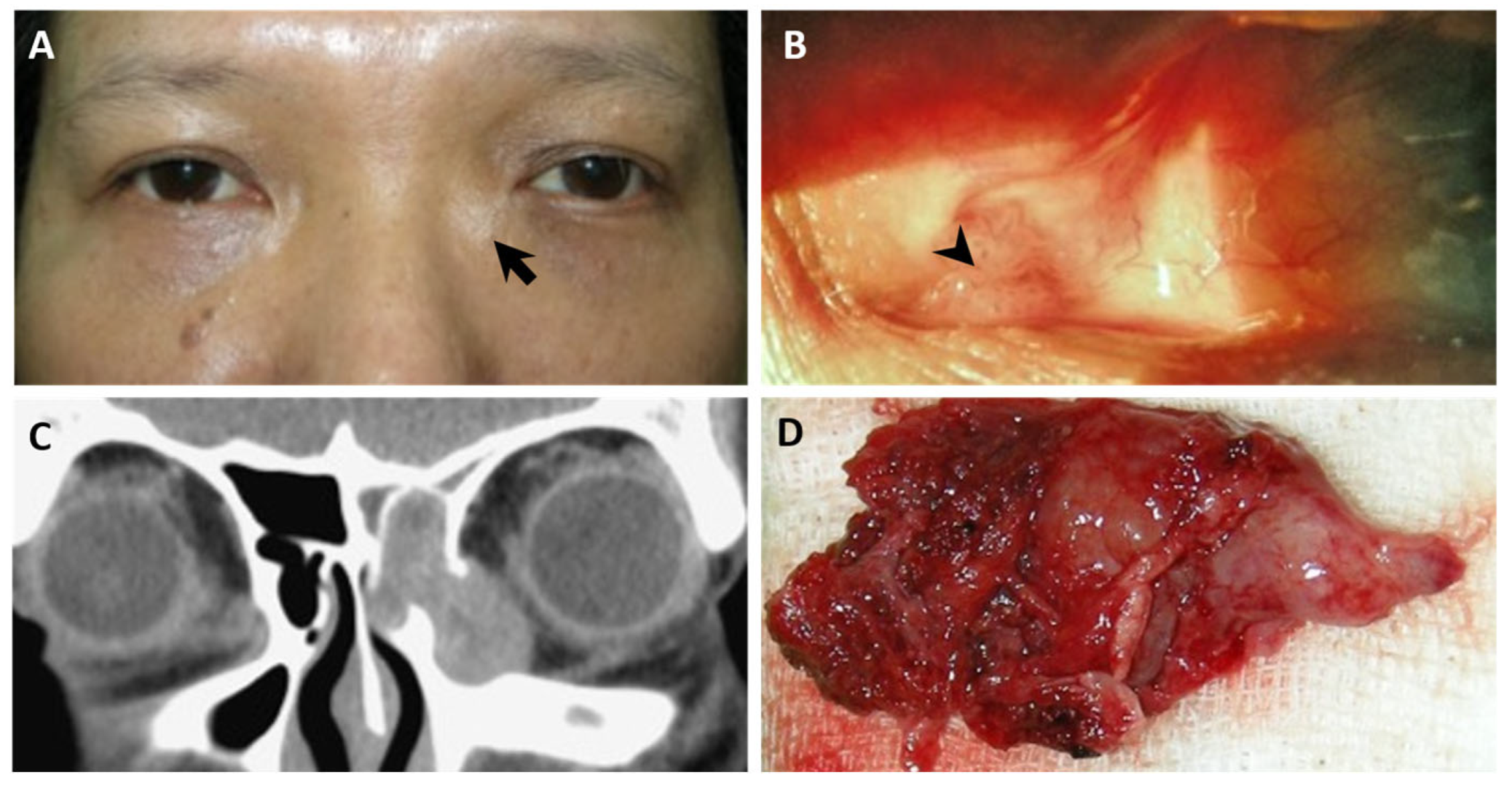 Diagnostics 14 02401 g002