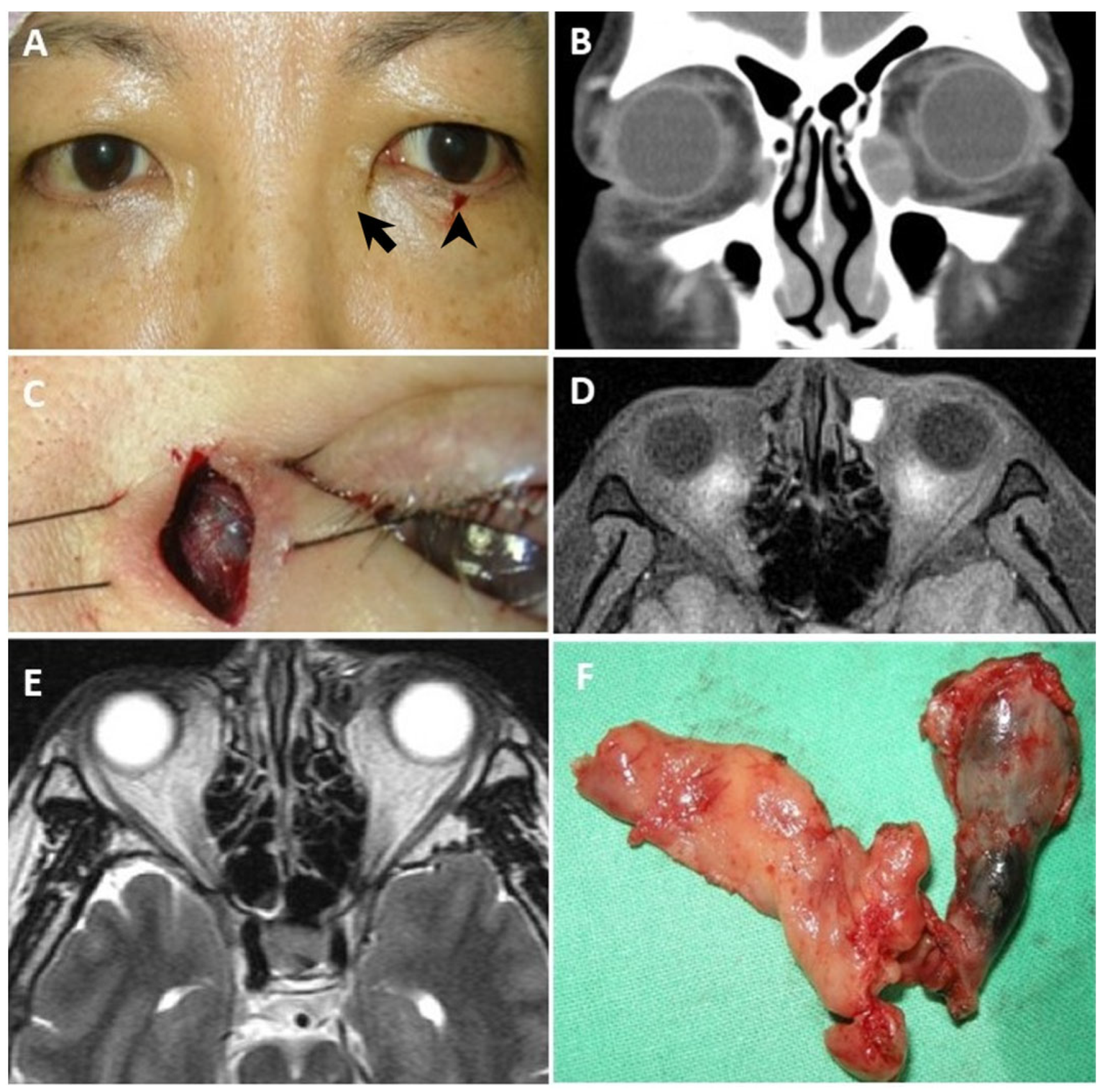 Diagnostics 14 02401 g004