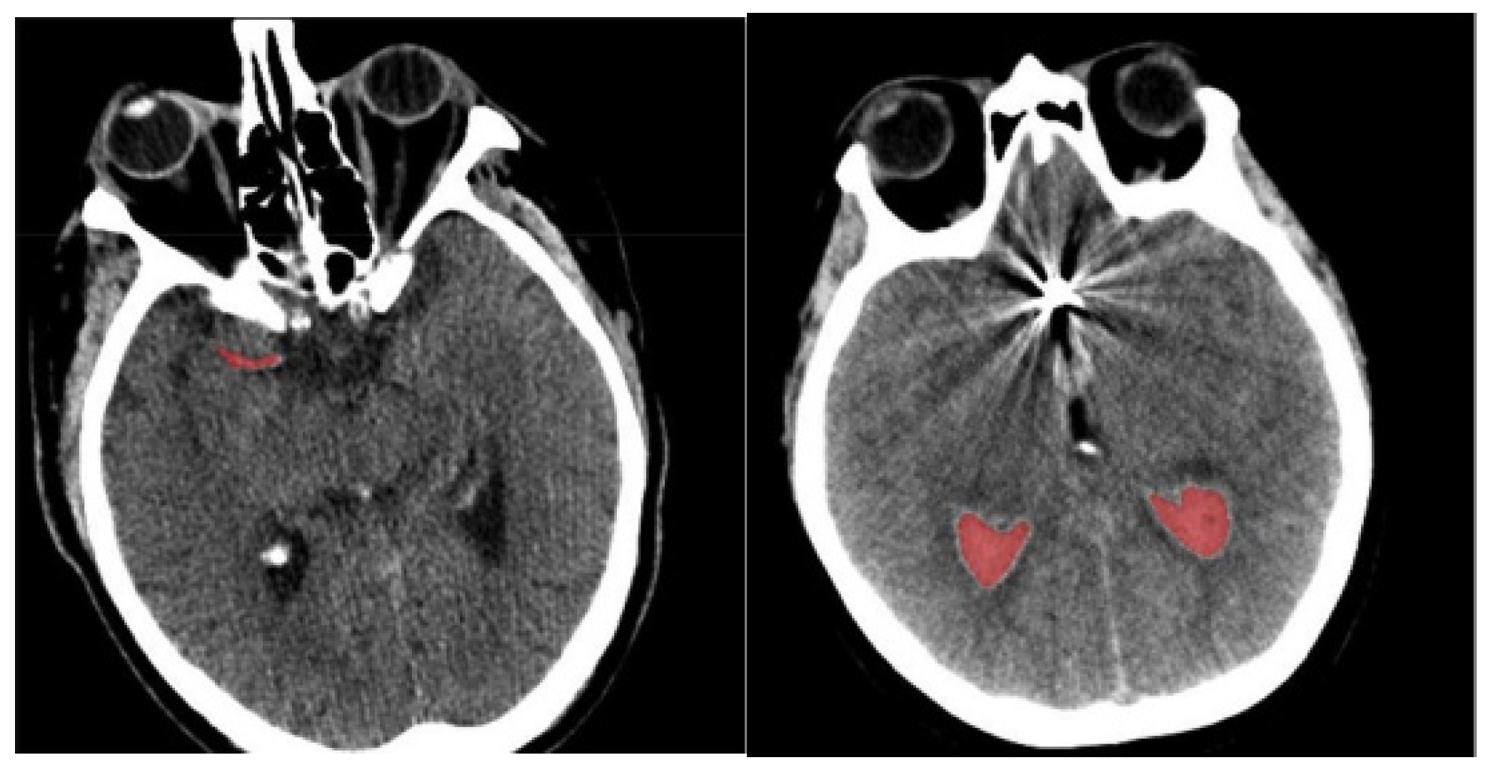 Diagnostics 14 02417 g003
