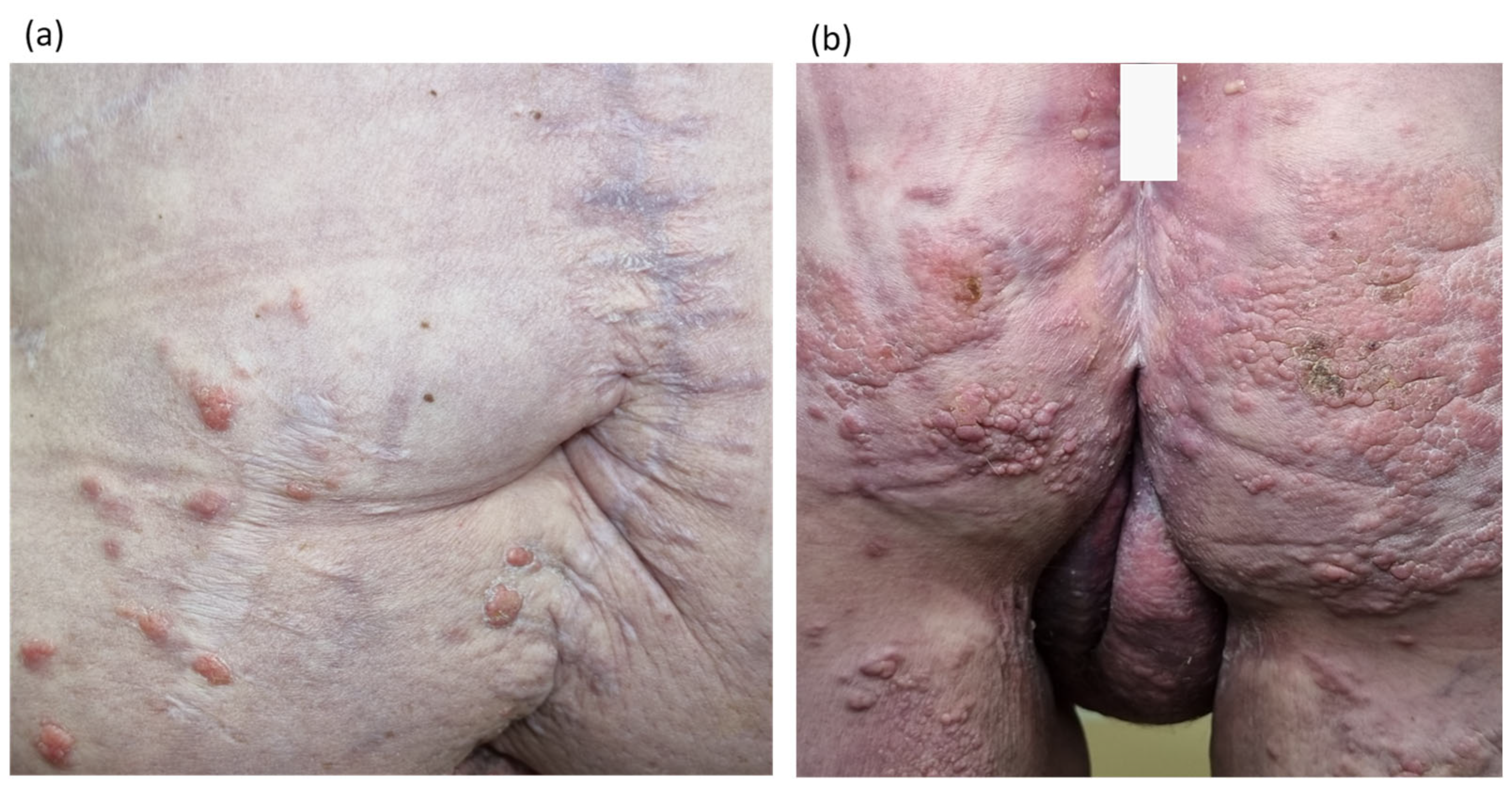 Diagnostics 14 02420 g006