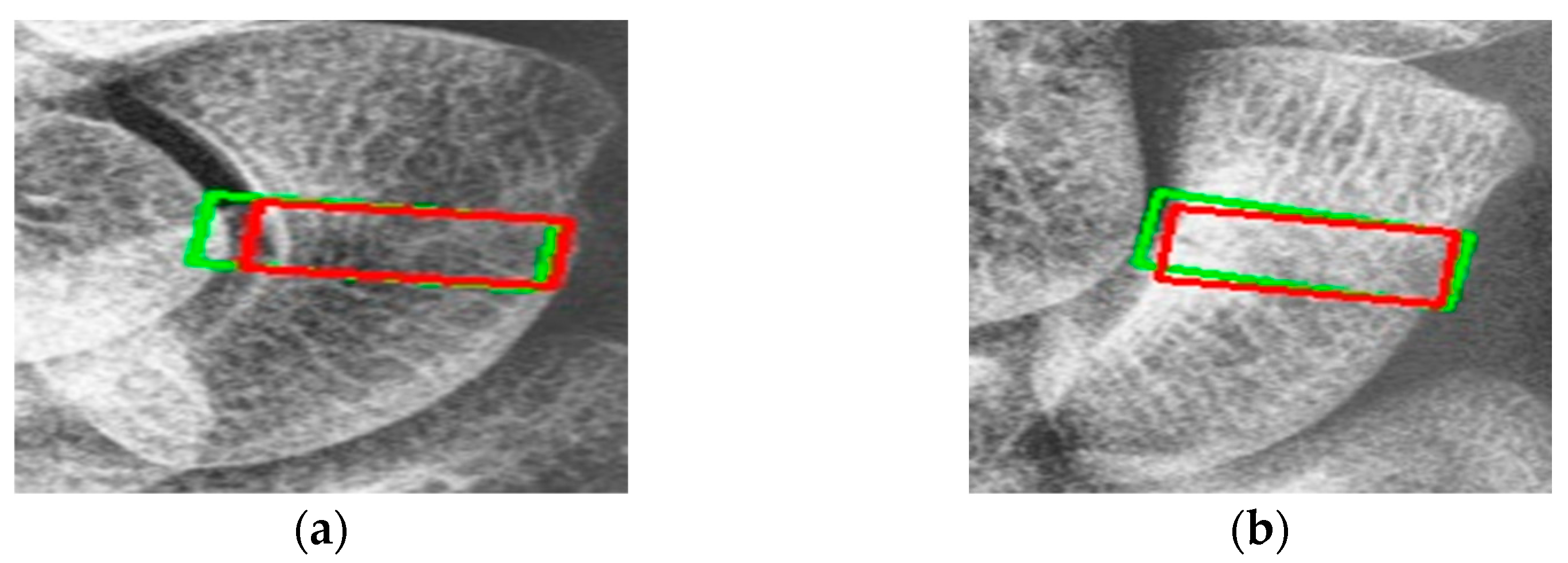 Diagnostics 14 02425 g011