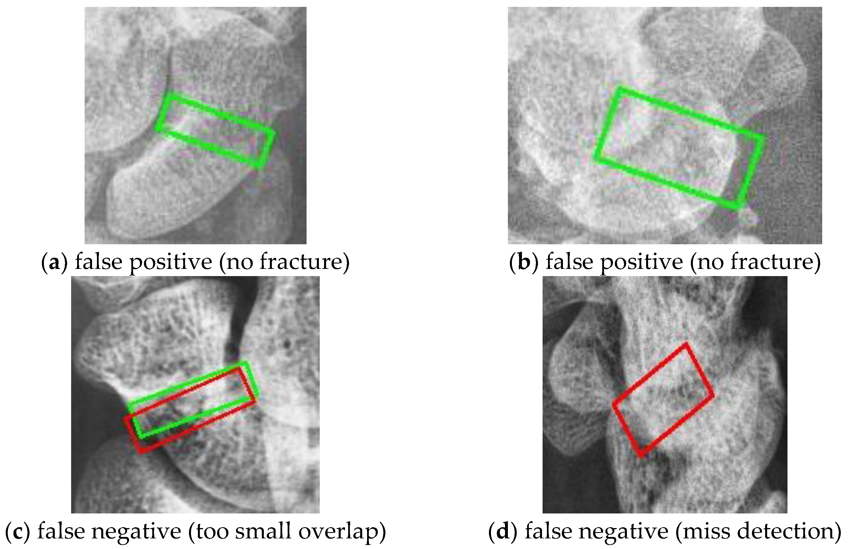 Diagnostics 14 02425 g013