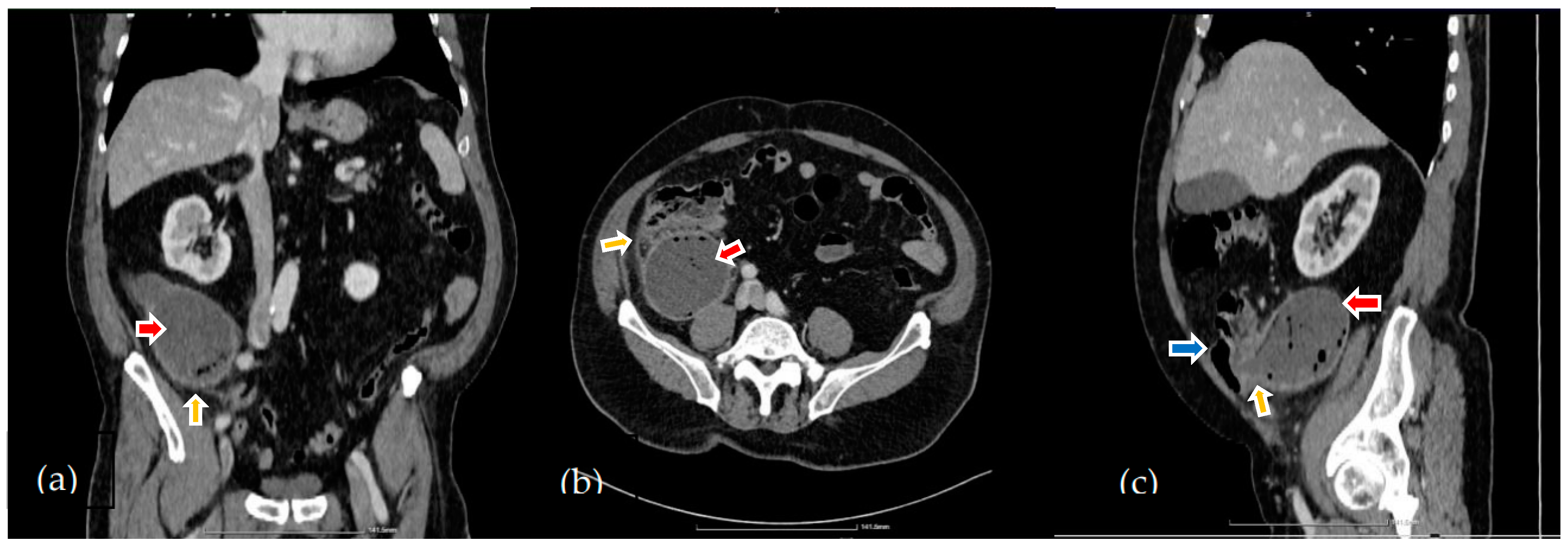 Diagnostics 14 02429 g001