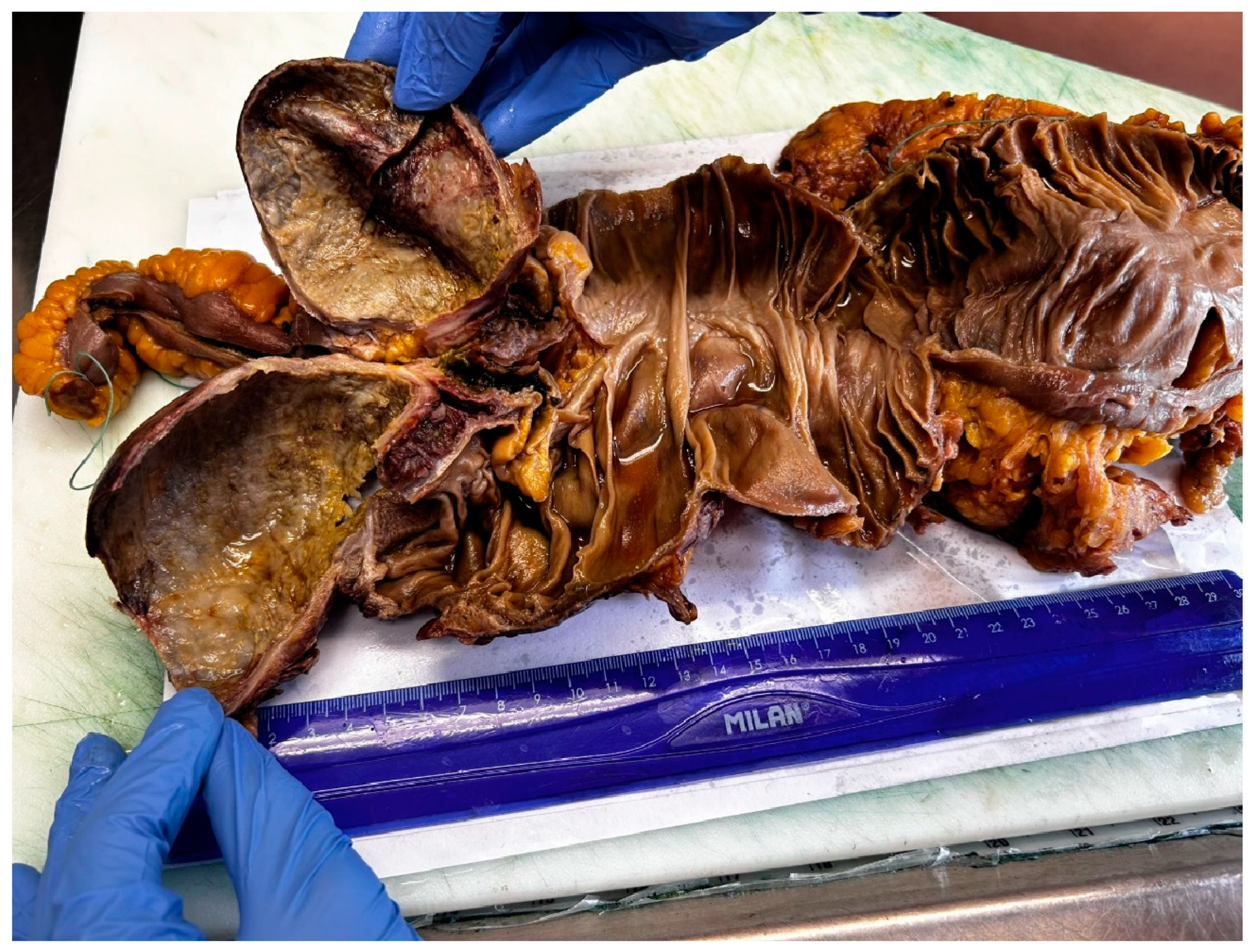 Diagnostics 14 02429 g003