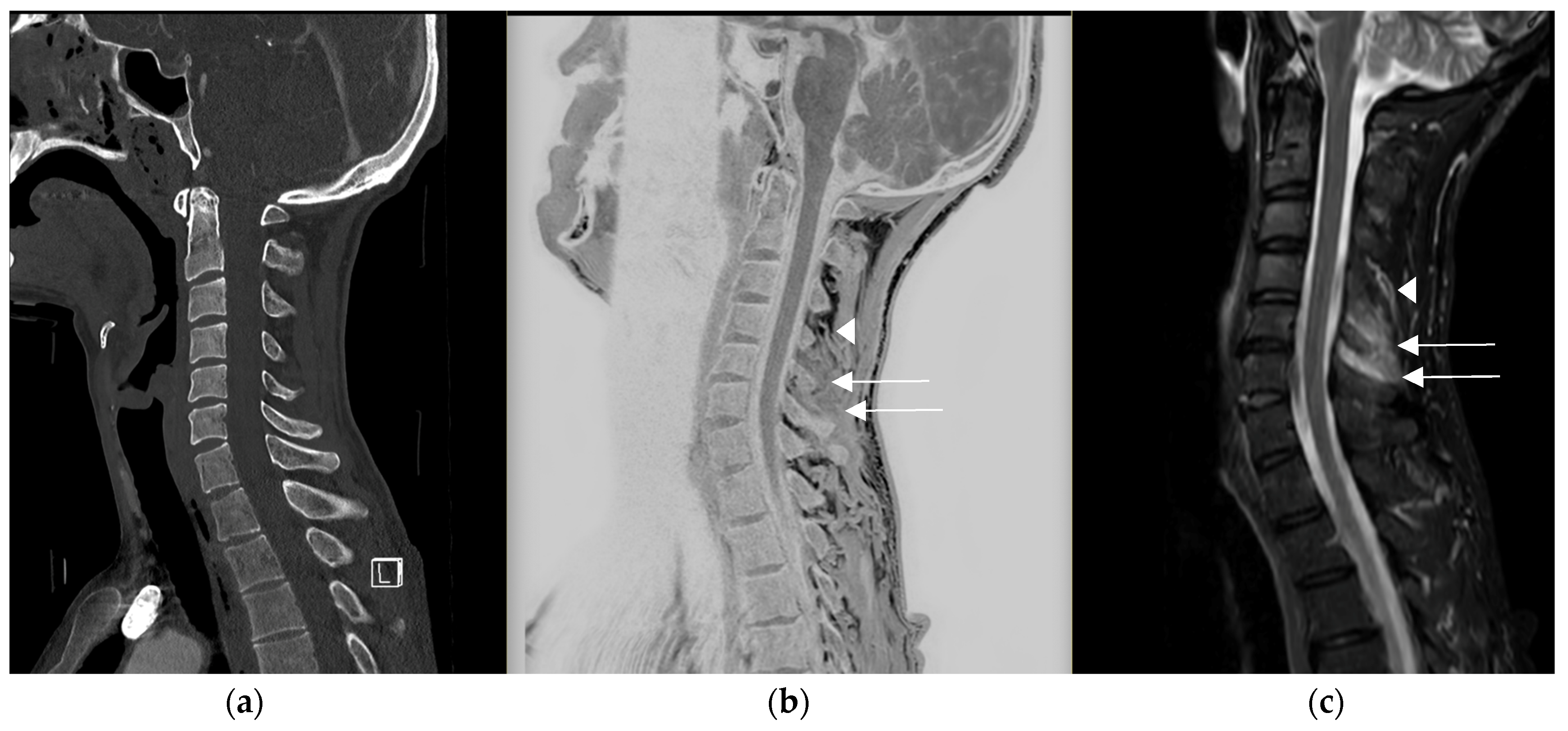 Diagnostics 14 02434 g004