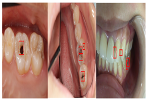 Diagnostics 14 02442 i008