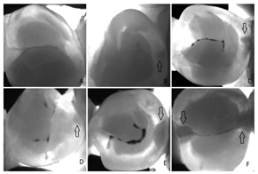 Diagnostics 14 02442 i009