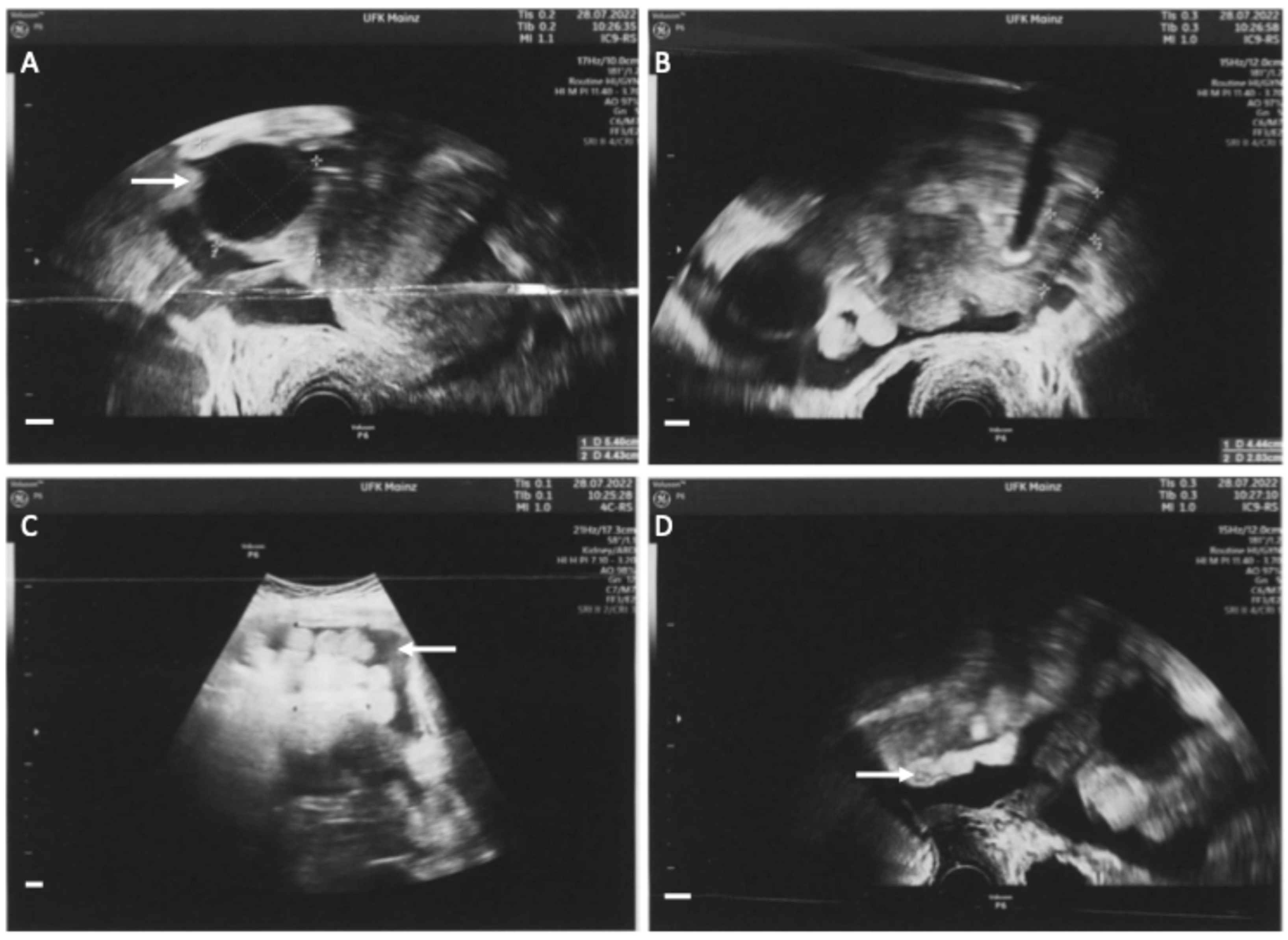 Diagnostics 14 02449 g001