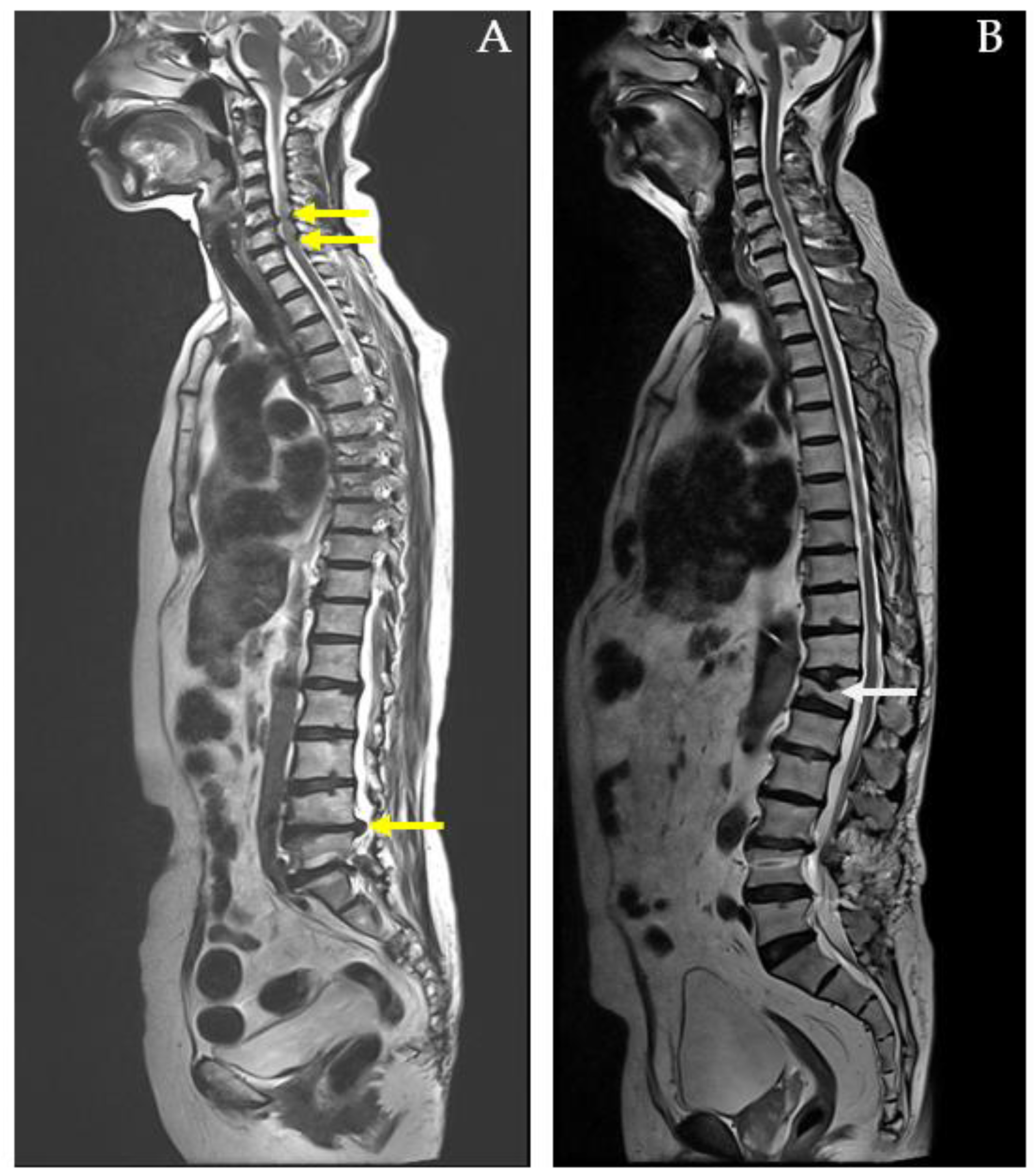 Diagnostics 14 02456 g002
