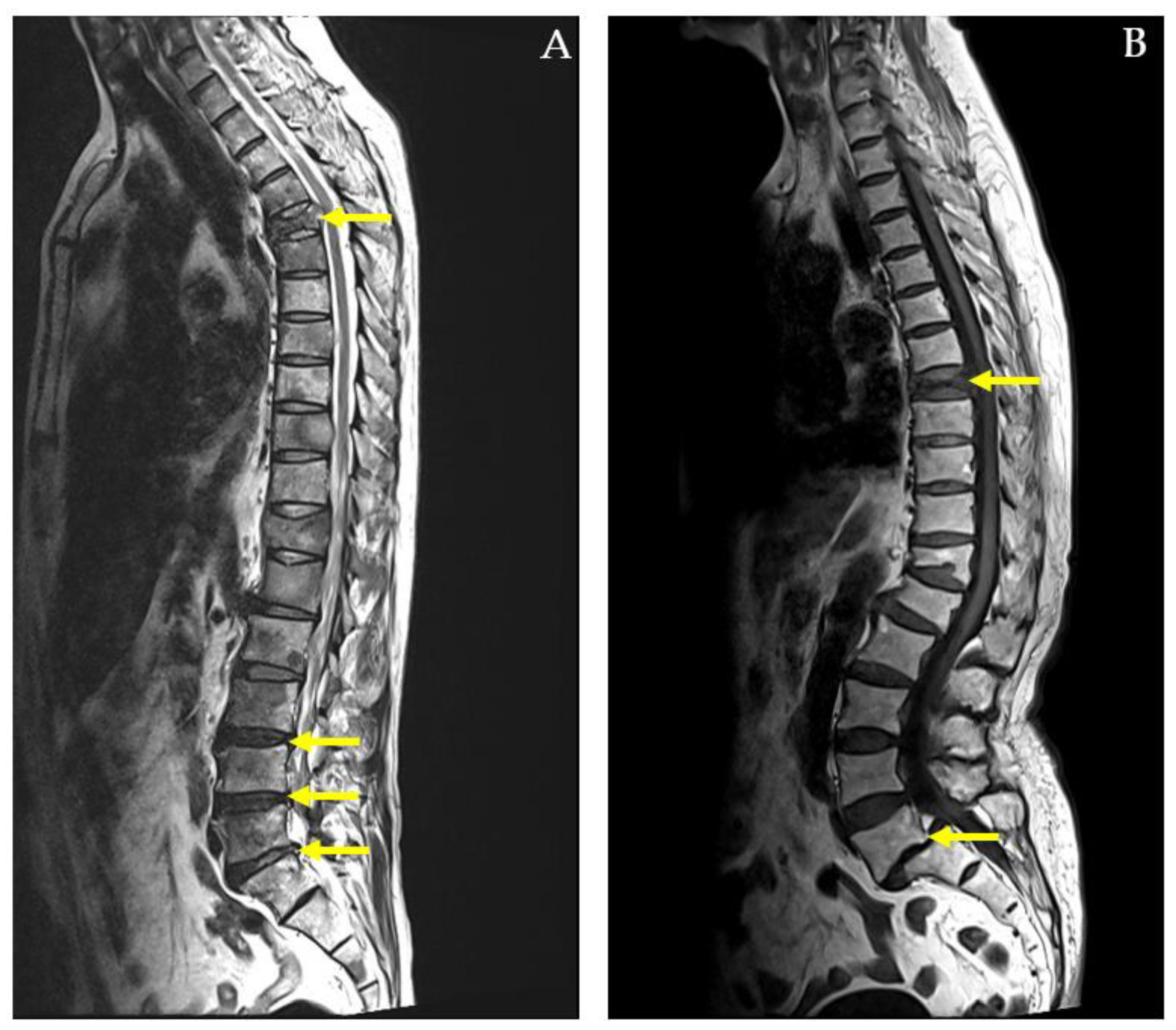 Diagnostics 14 02456 g004
