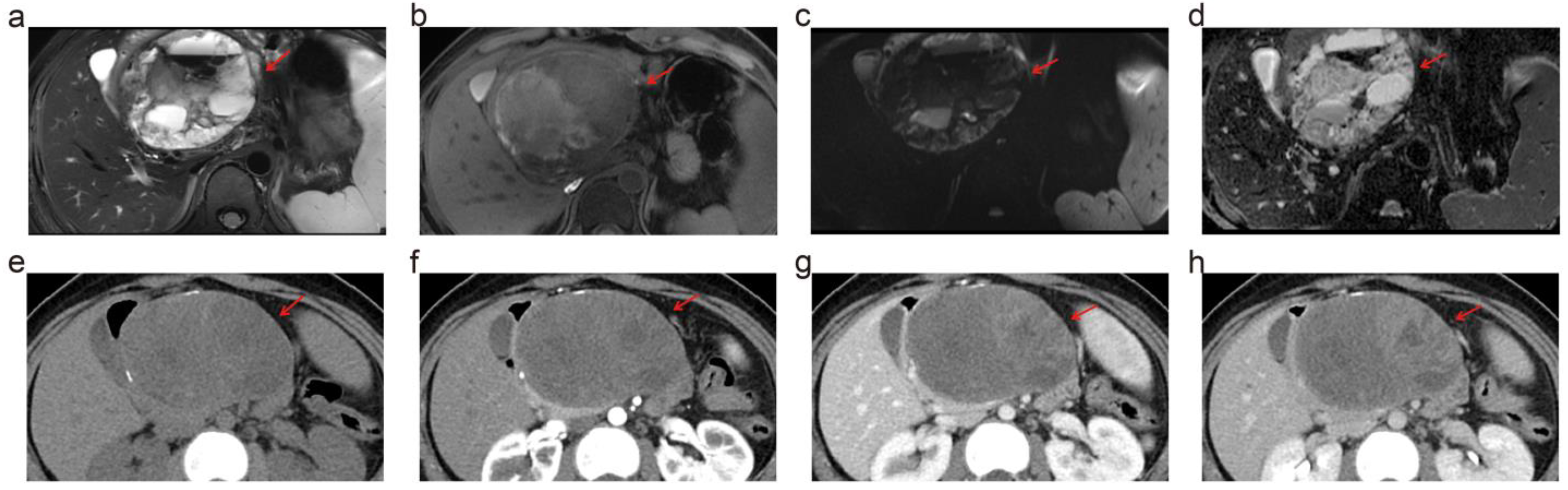 Diagnostics 14 02457 g004
