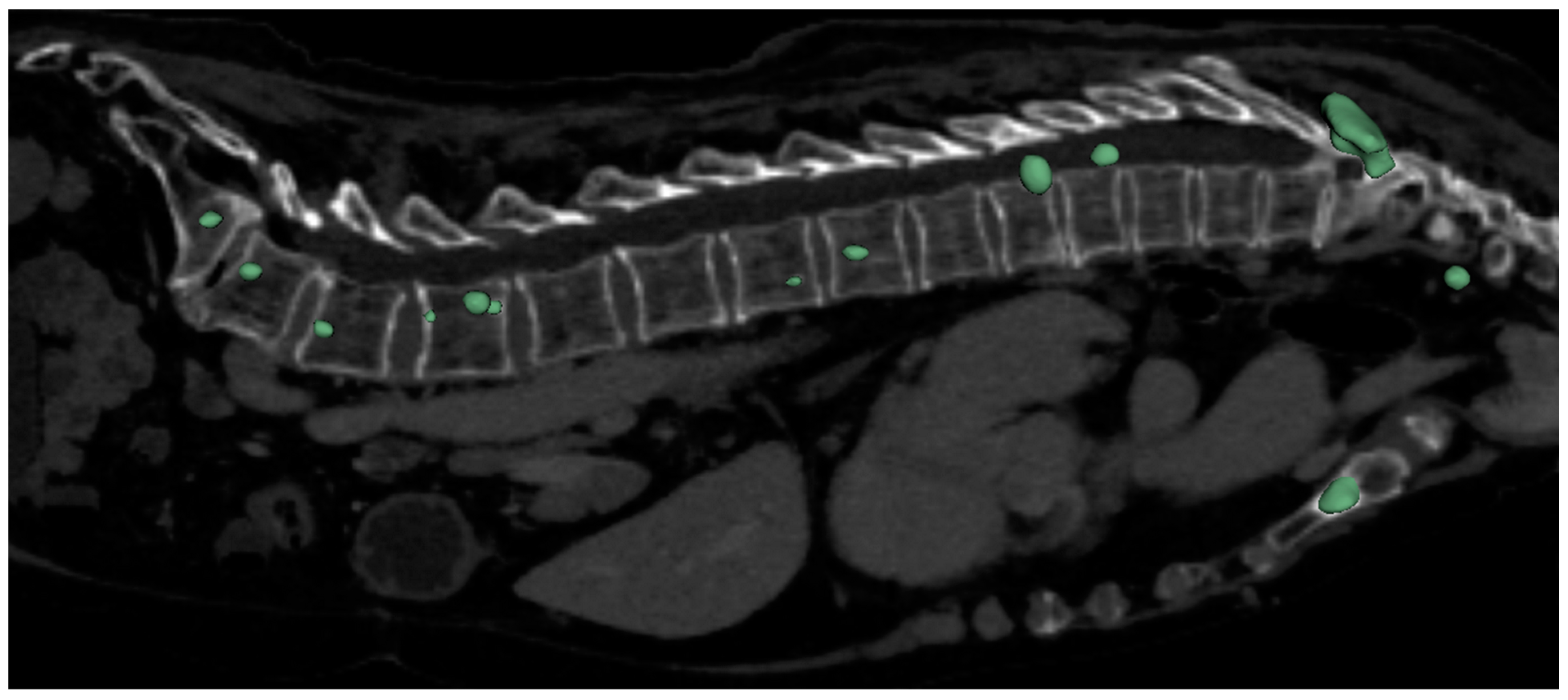 Diagnostics 14 02458 g004