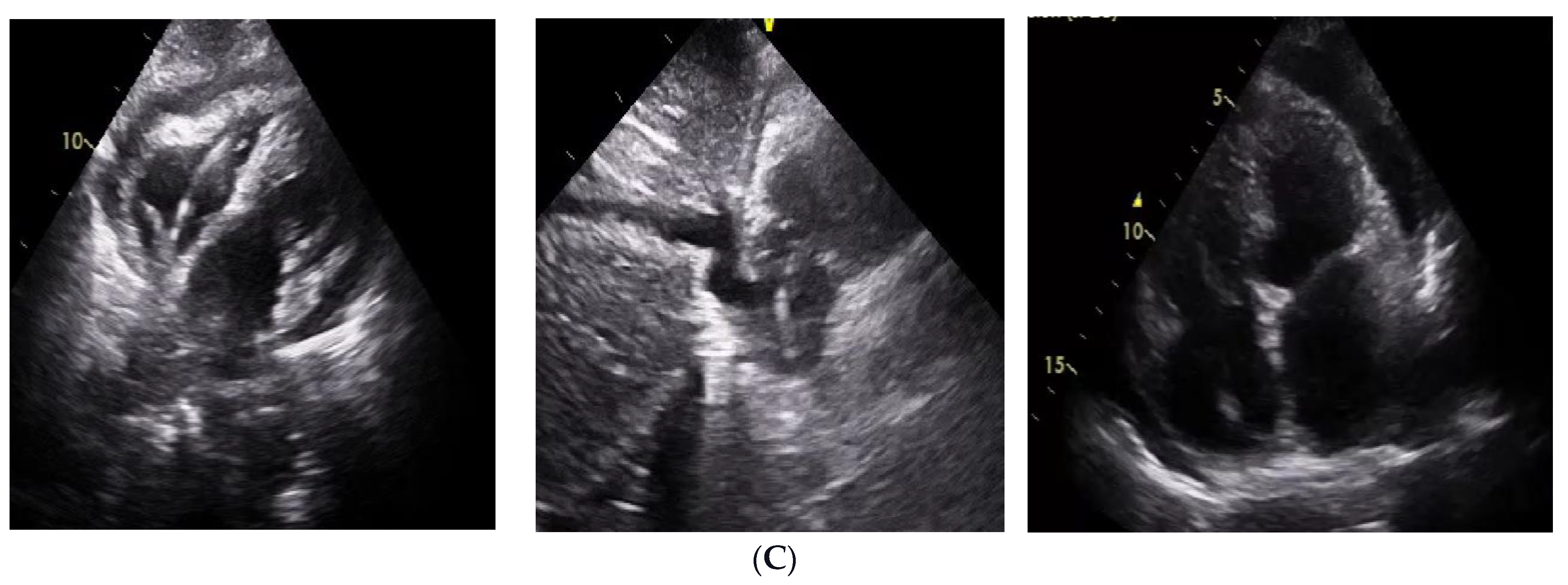 Diagnostics 14 02465 g004b