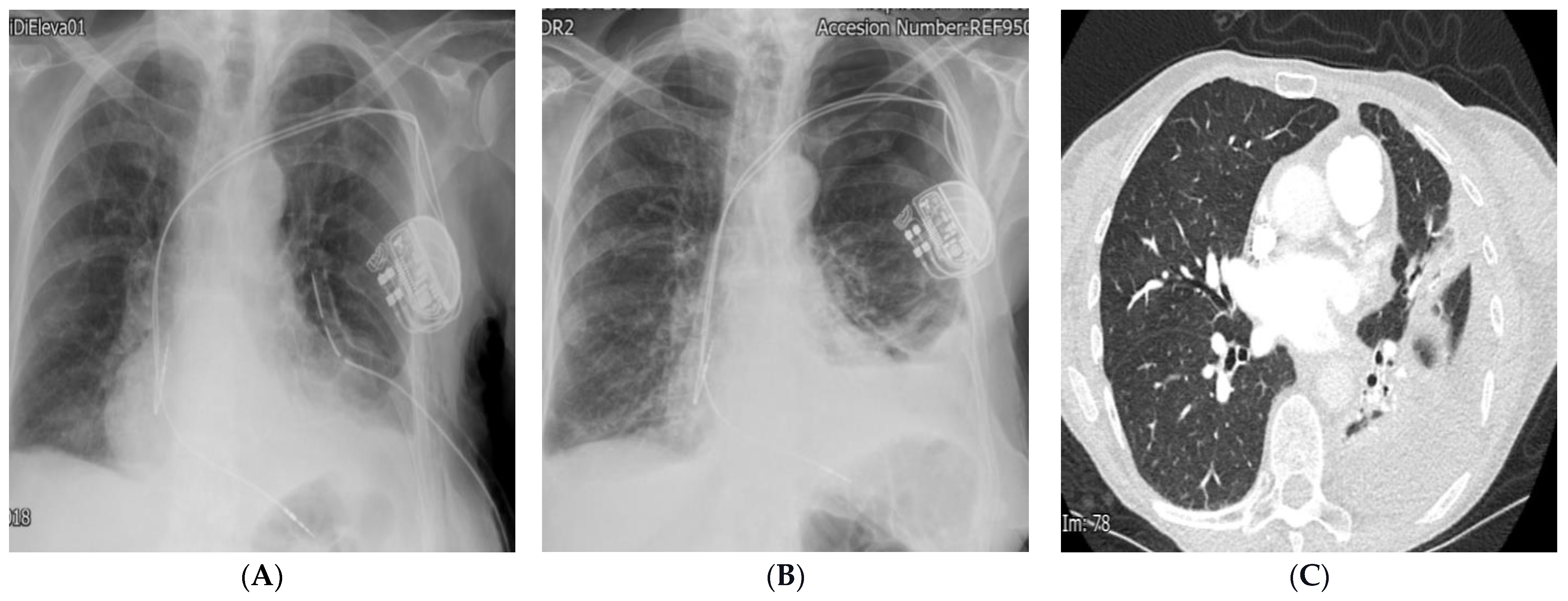 Diagnostics 14 02465 g005