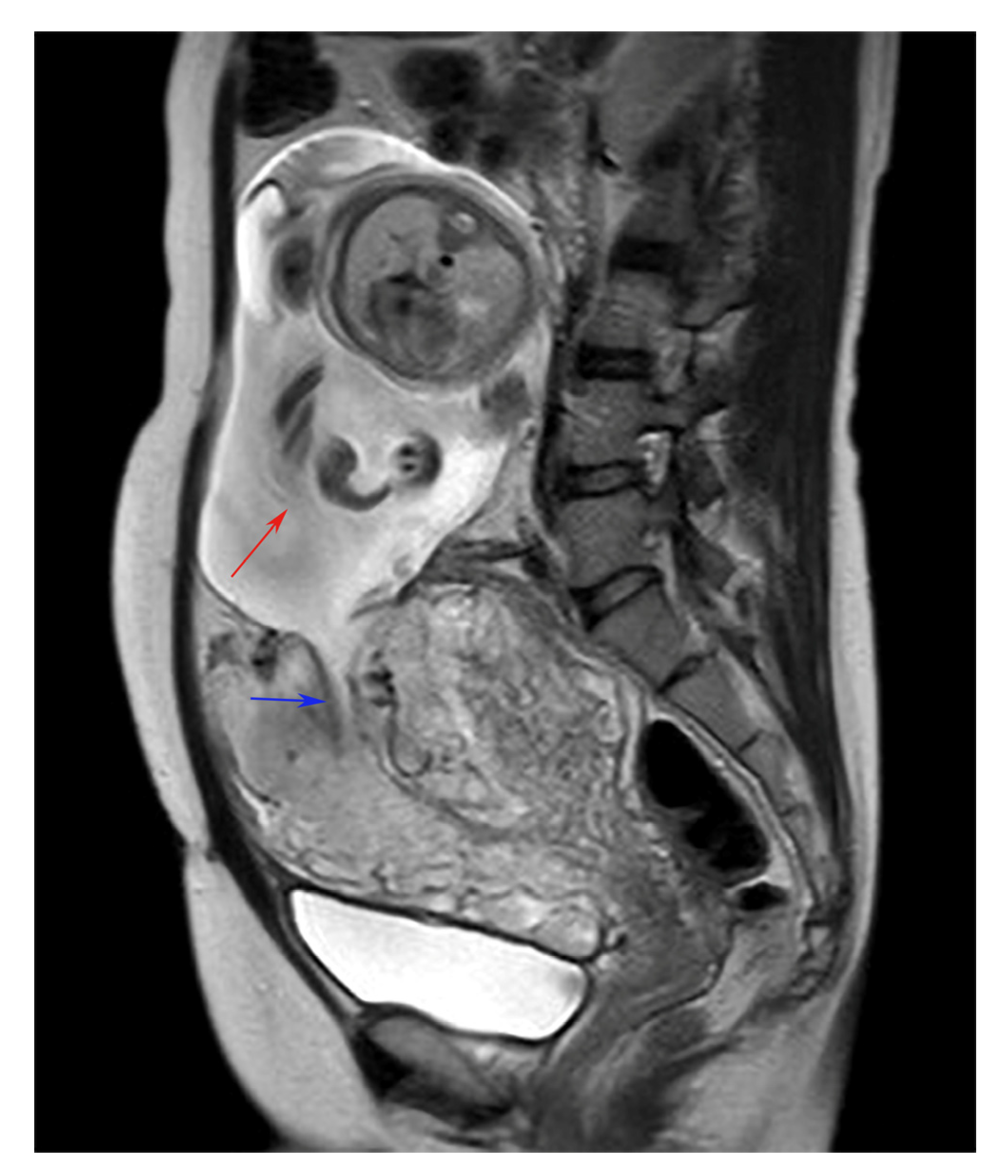 Diagnostics 14 02470 g001 Diagnostics 14 02470 g001
