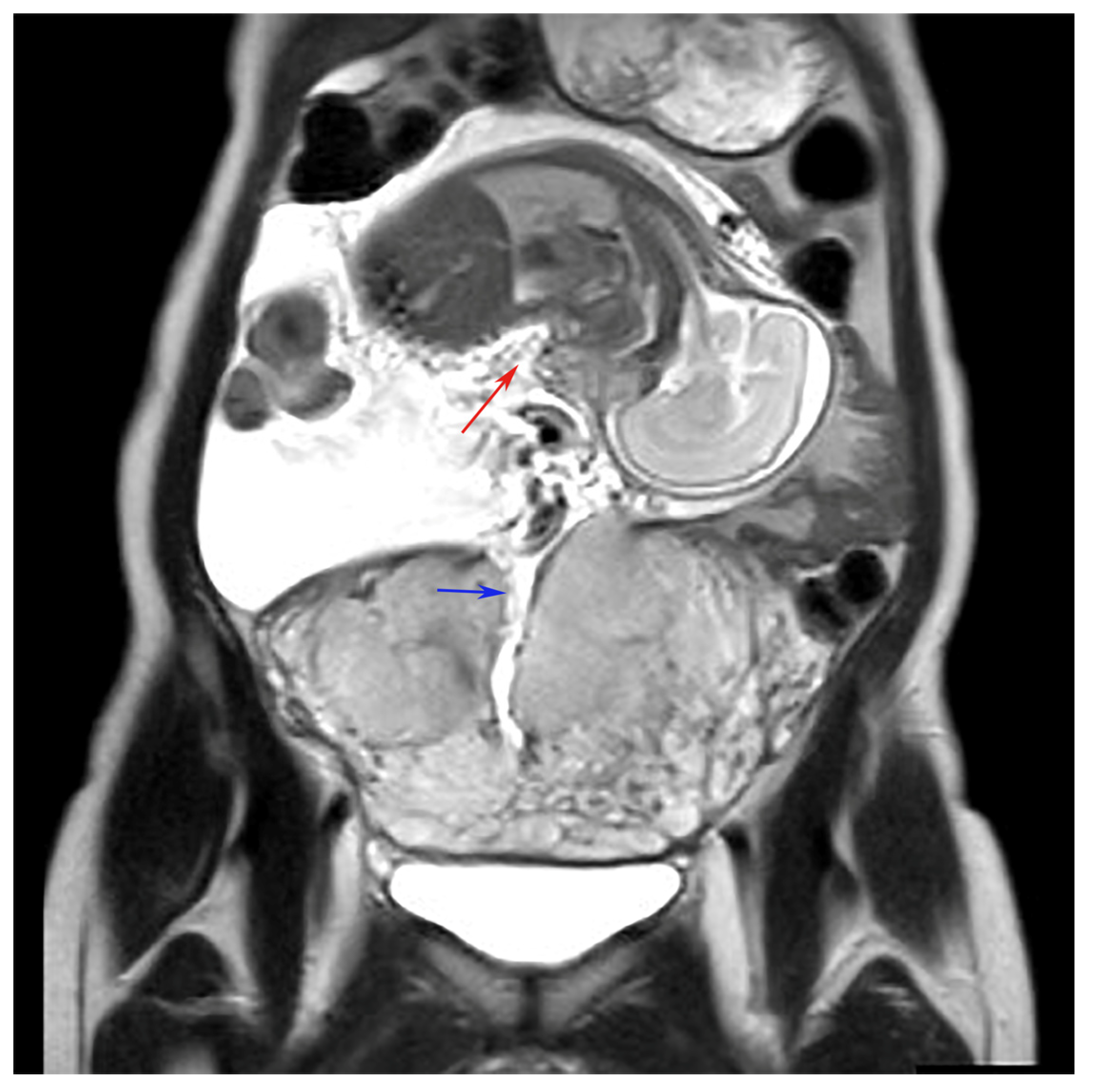 Diagnostics 14 02470 g002 Diagnostics 14 02470 g002