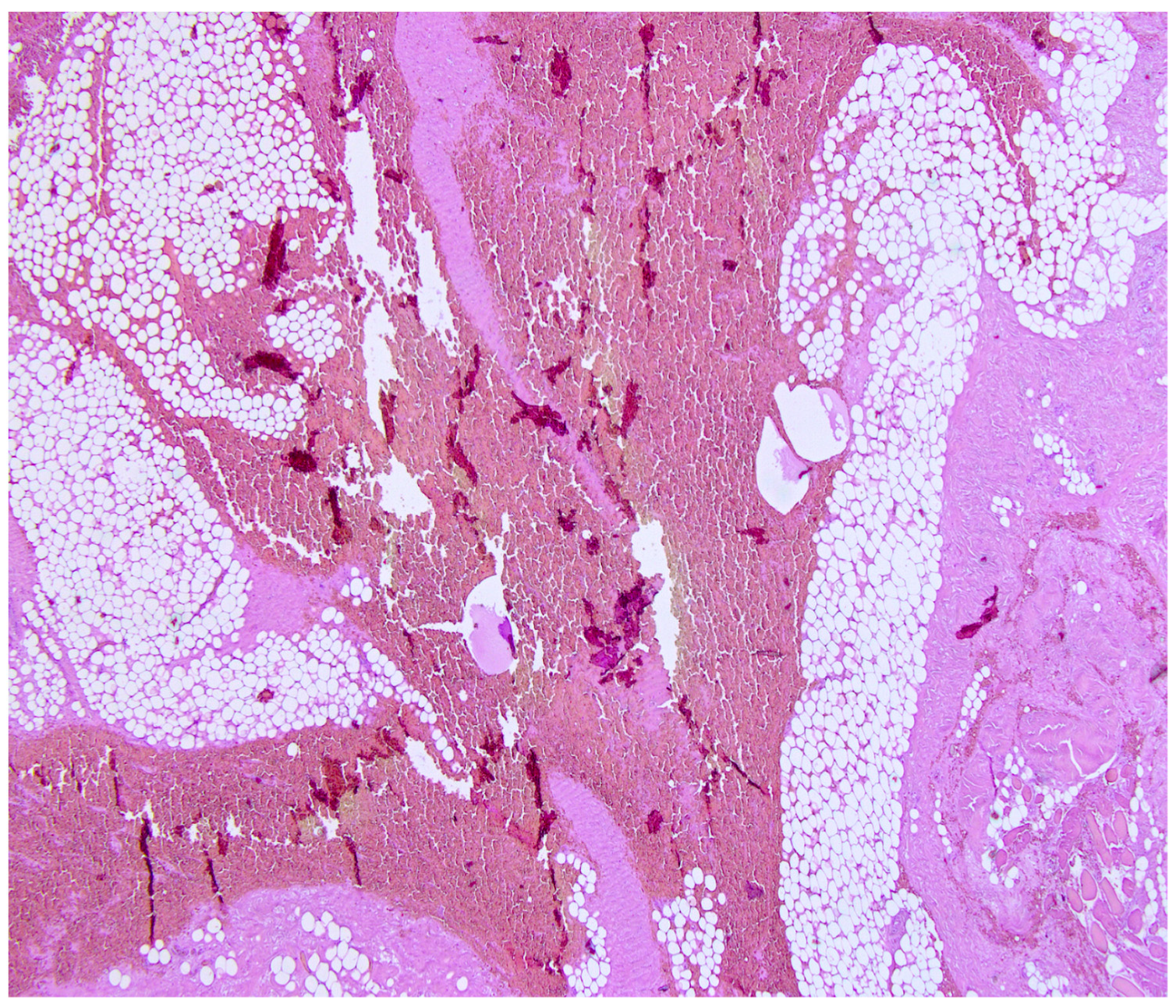 Diagnostics 14 02472 g005