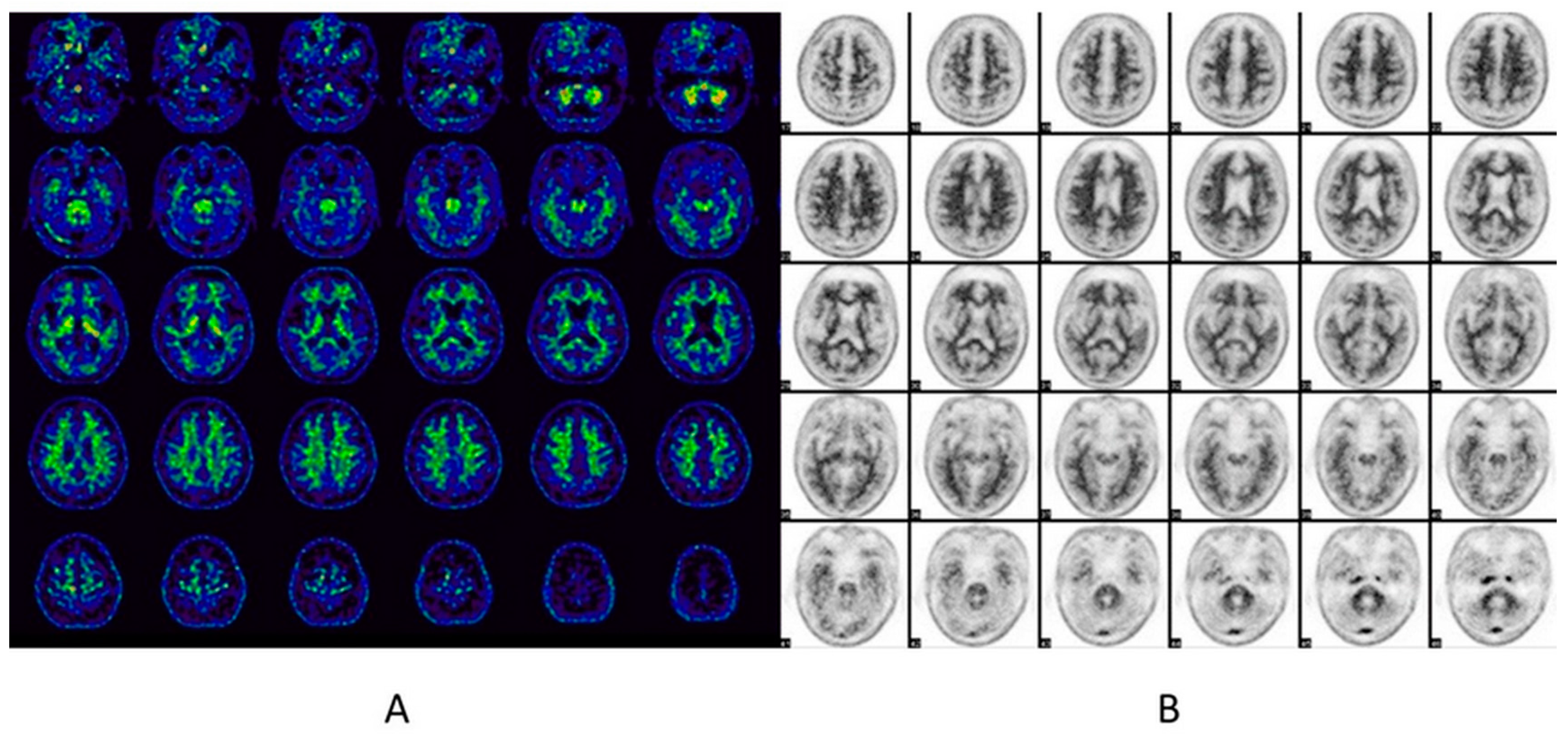 Diagnostics 14 02474 g004